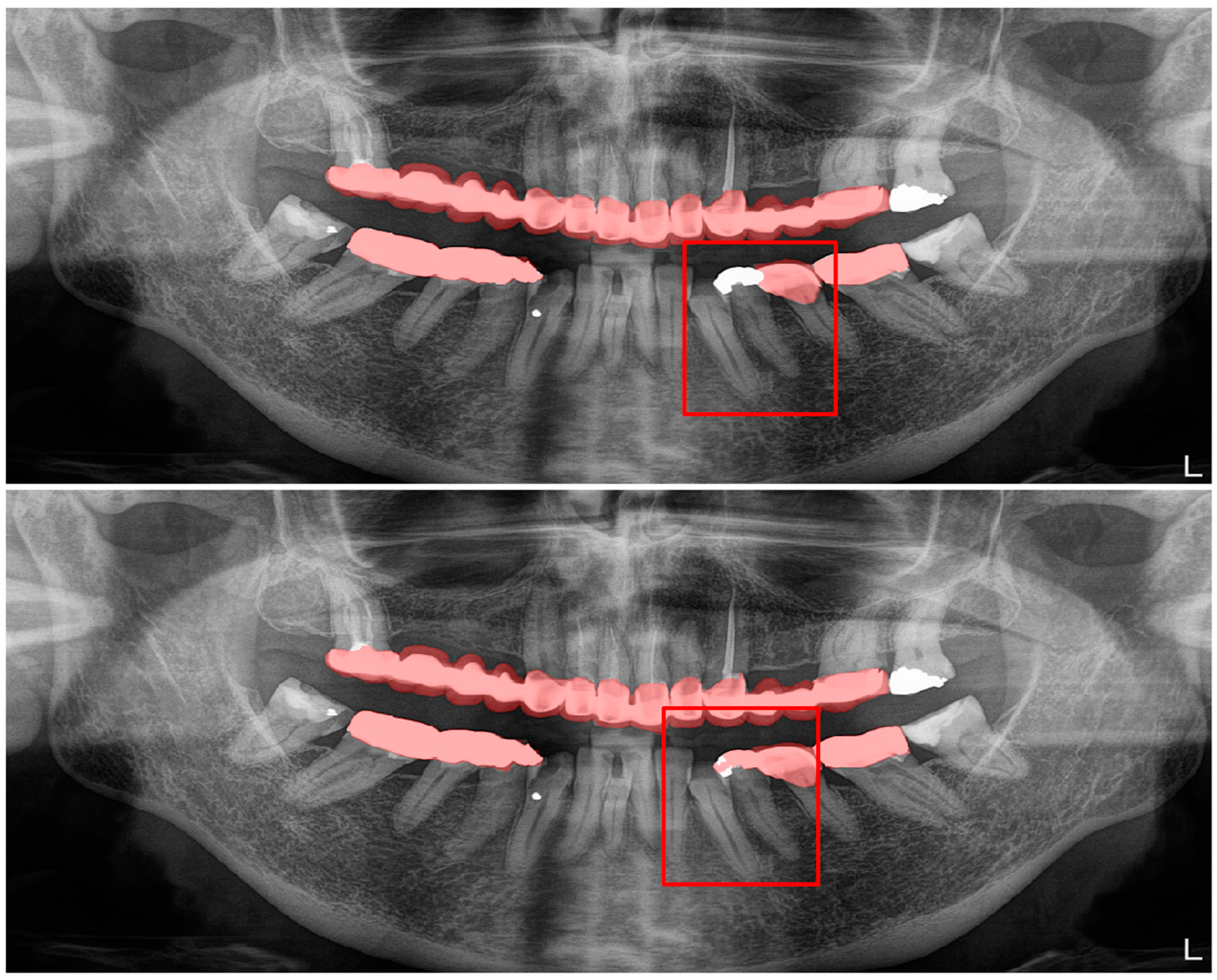 Diagnostics 13 01487 g010 Diagnostics 13 01487 g010