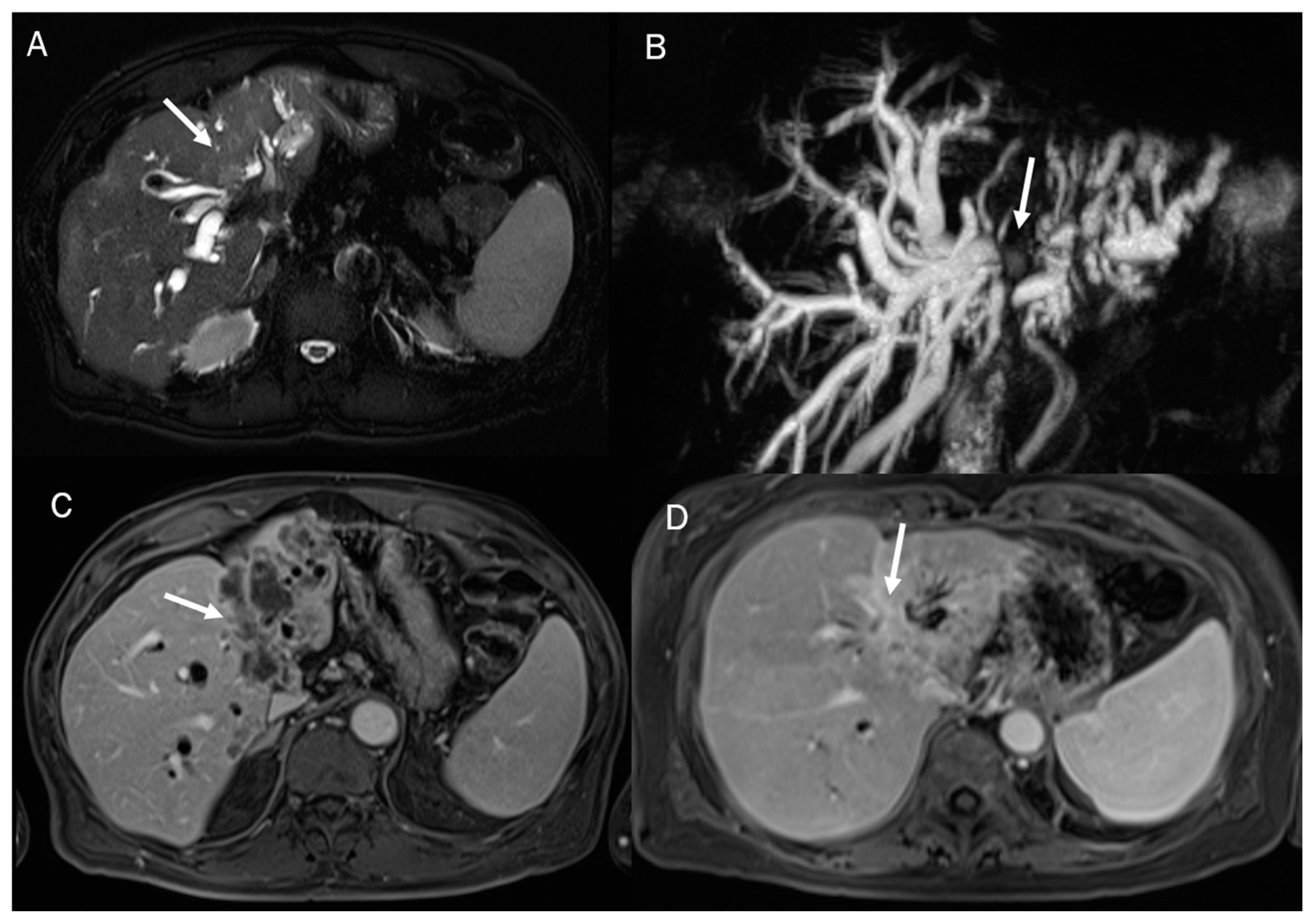 Diagnostics 13 01488 g006