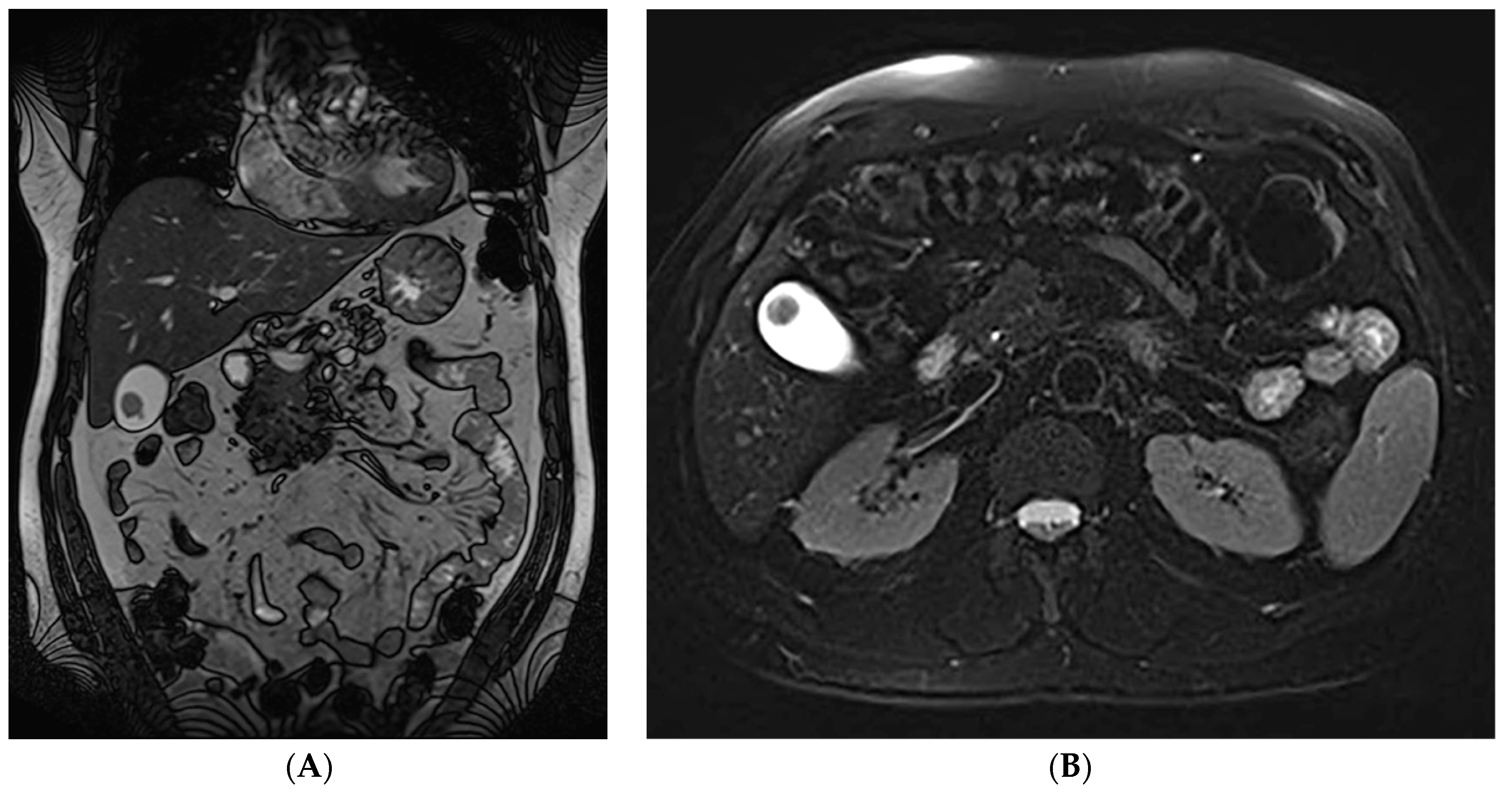 Diagnostics 13 01509 g001 Diagnostics 13 01509 g001