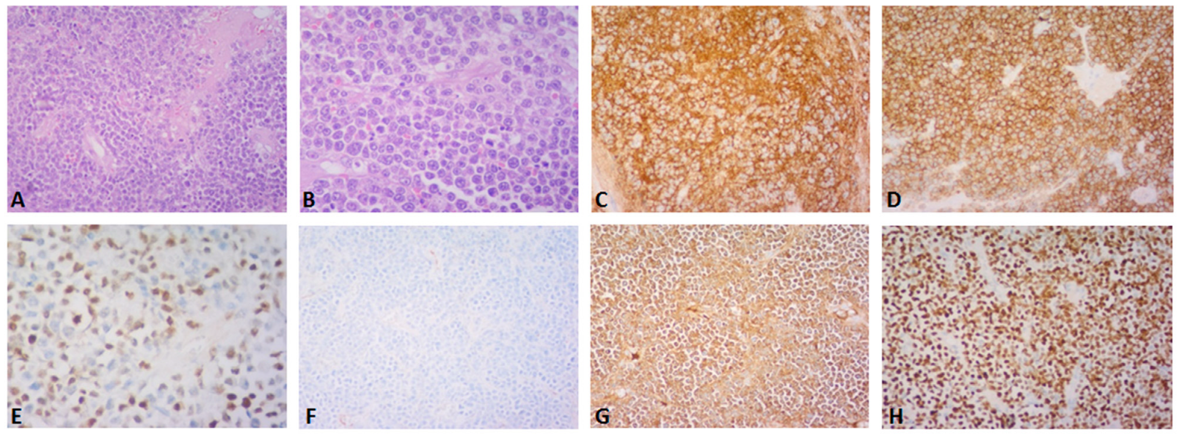 Diagnostics 13 01509 g002 Diagnostics 13 01509 g002