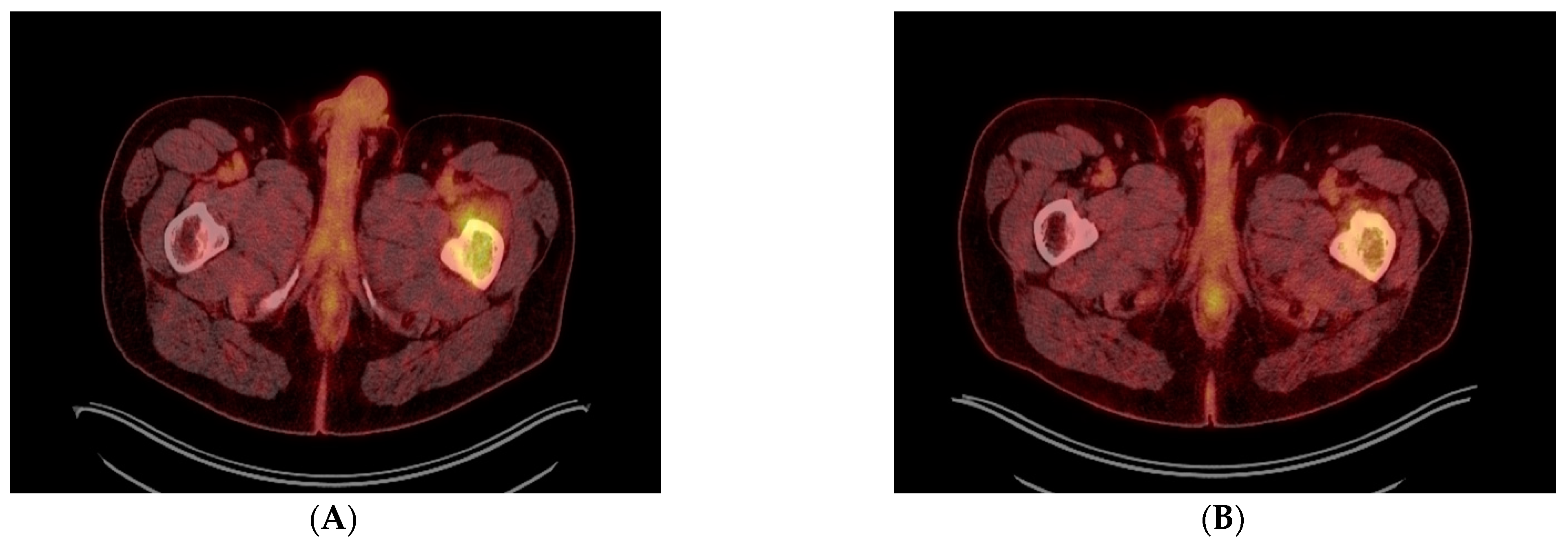 Diagnostics 13 01509 g003a Diagnostics 13 01509 g003a