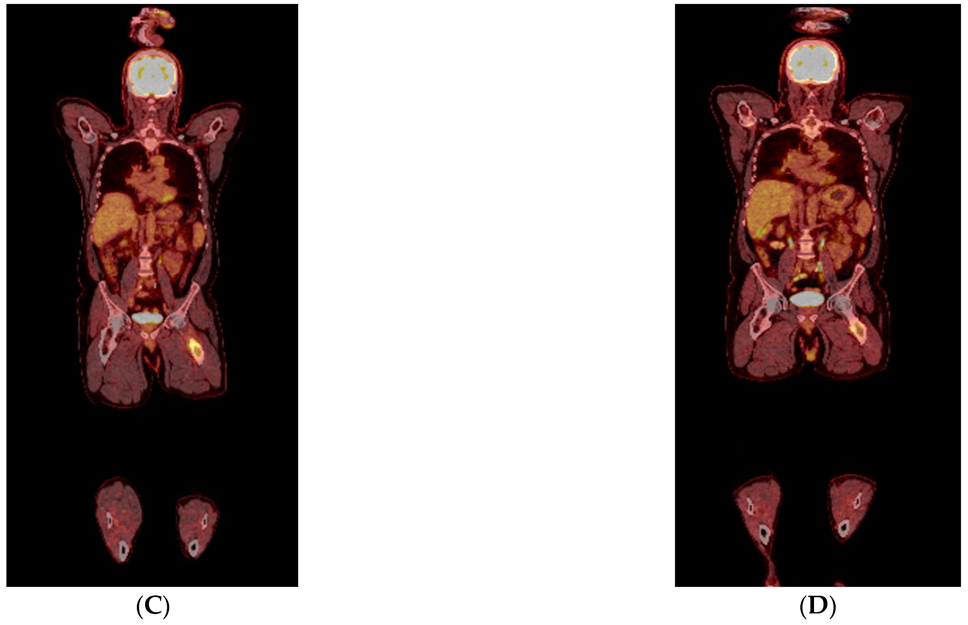 Diagnostics 13 01509 g003b Diagnostics 13 01509 g003b