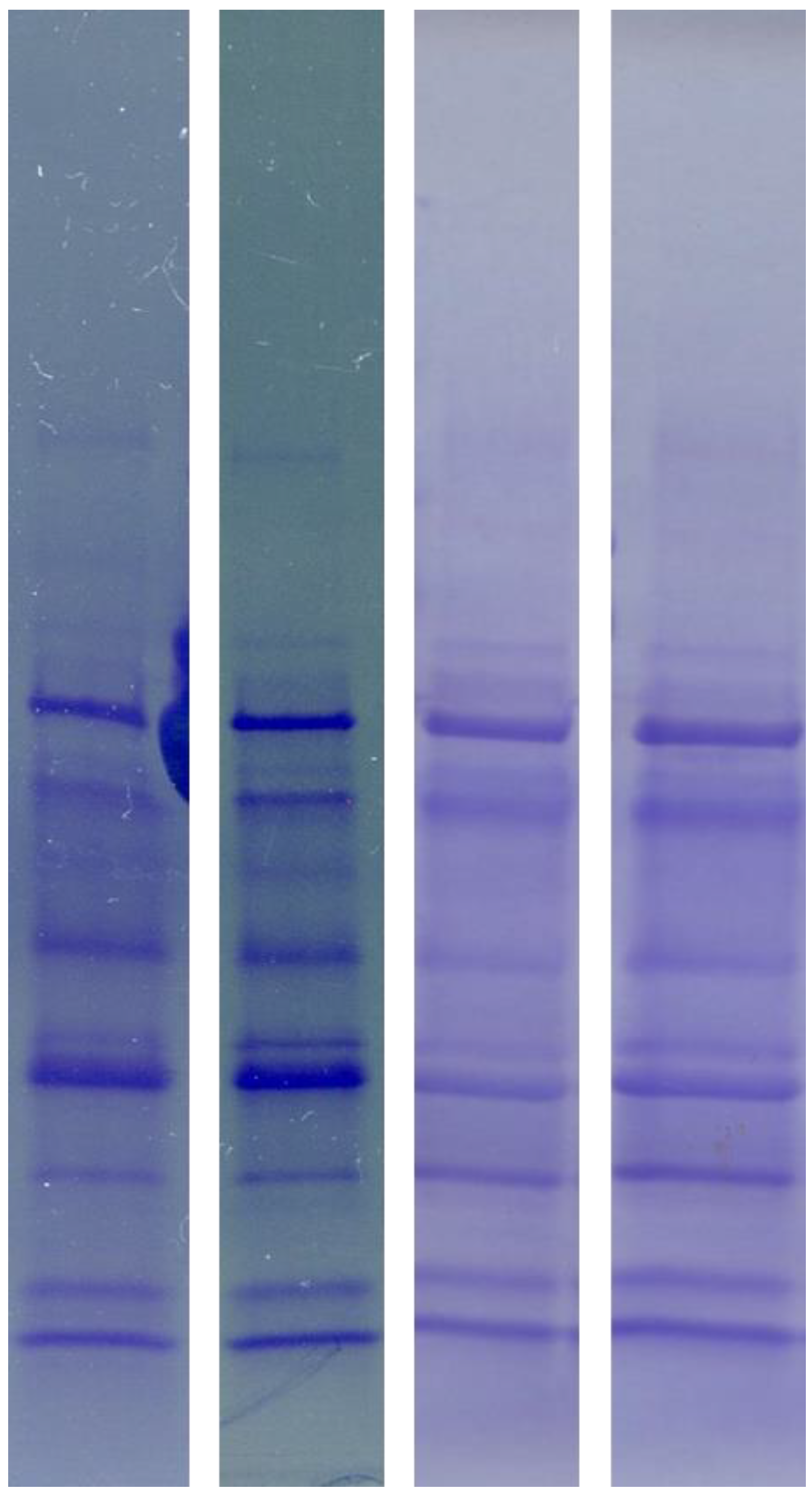 Diagnostics free full text sds electrophoresis on gradient