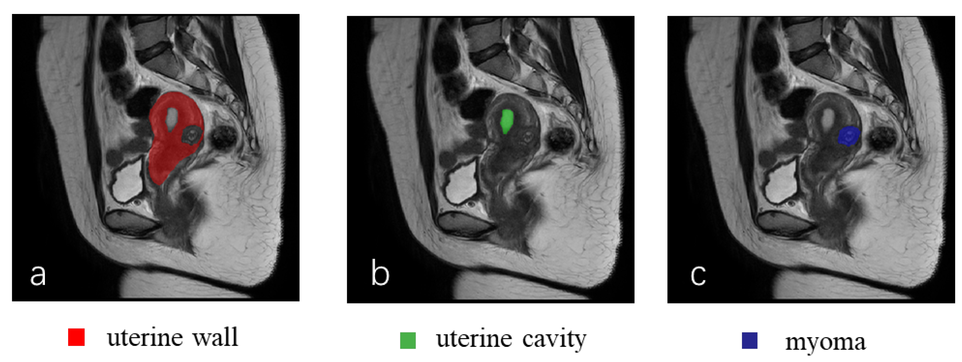 Diagnostics 13 01525 g003 Diagnostics 13 01525 g003