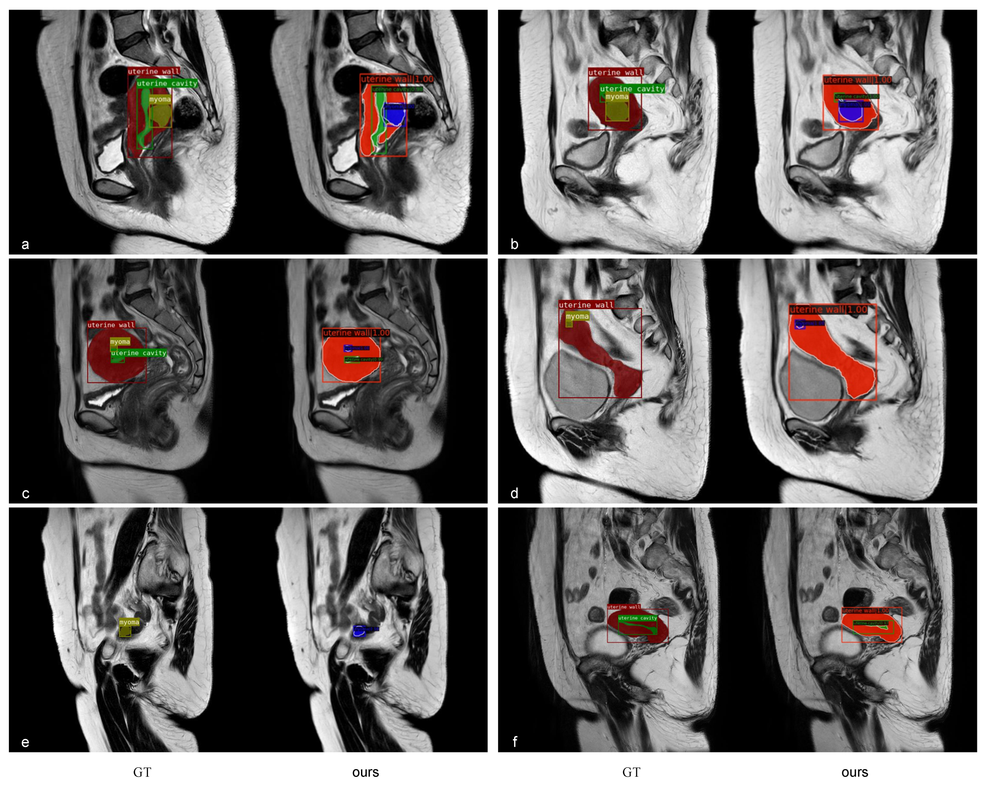 Diagnostics 13 01525 g014 Diagnostics 13 01525 g014