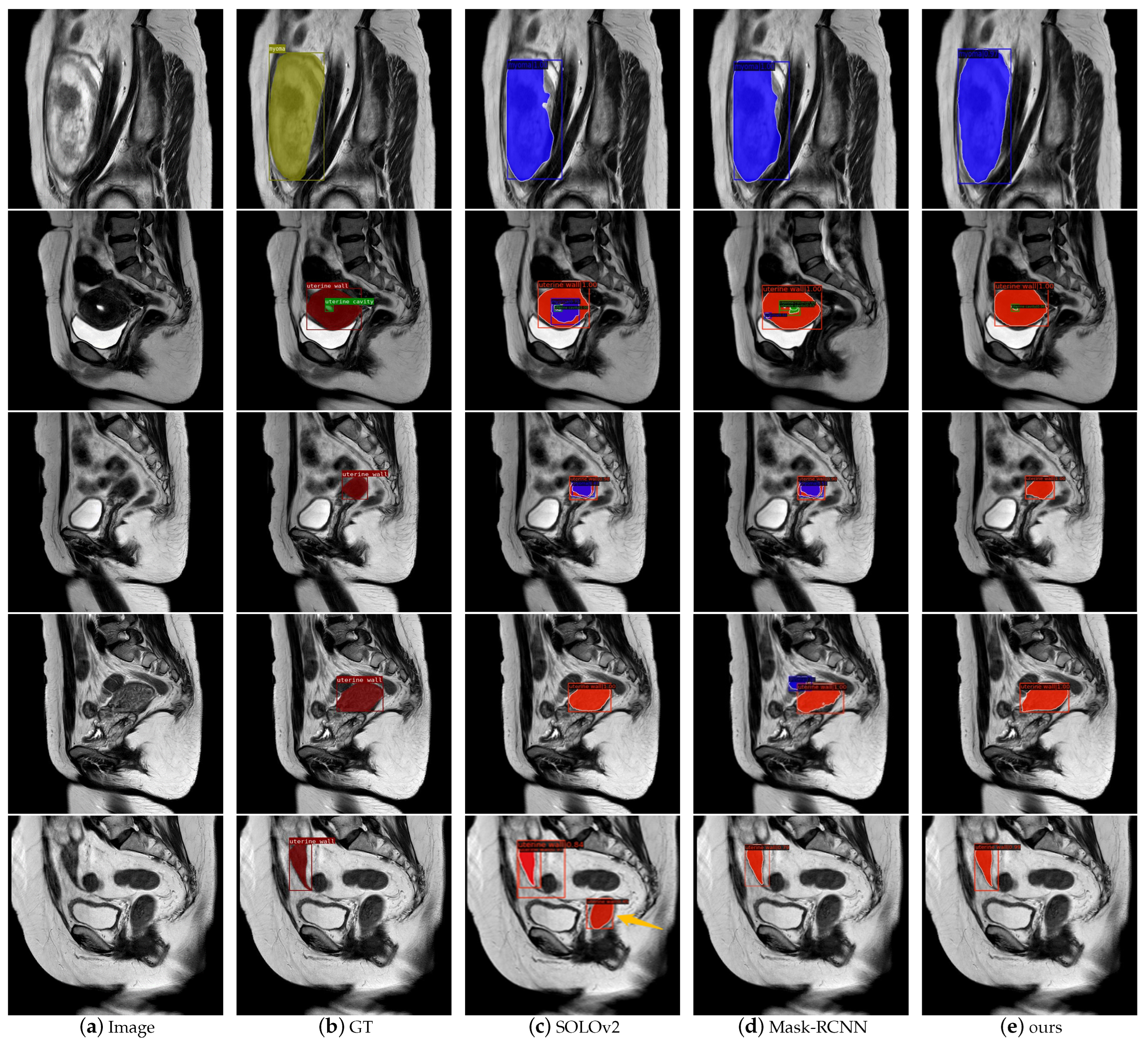 Diagnostics 13 01525 g016 Diagnostics 13 01525 g016