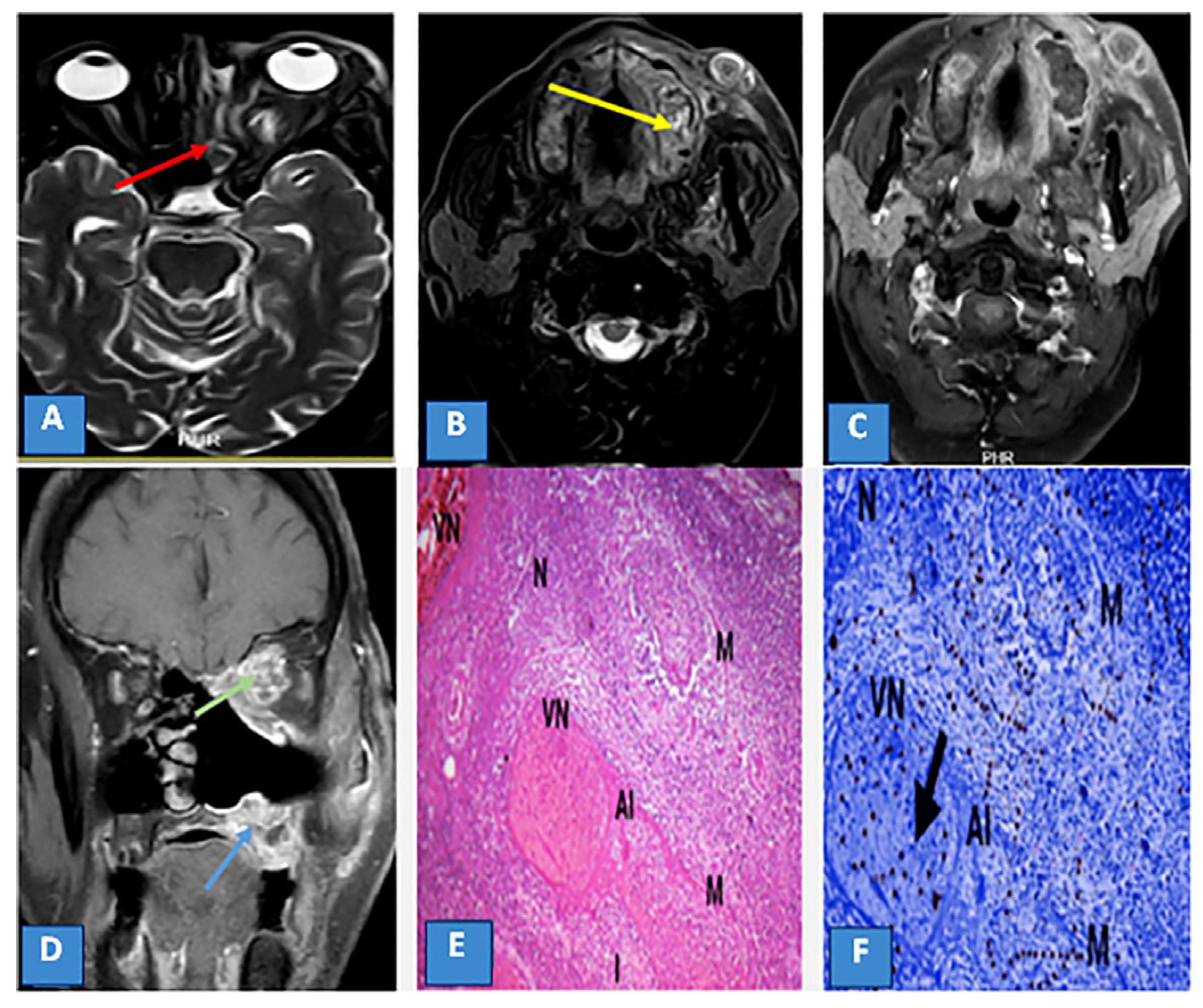 Diagnostics 13 01546 g003 Diagnostics 13 01546 g003