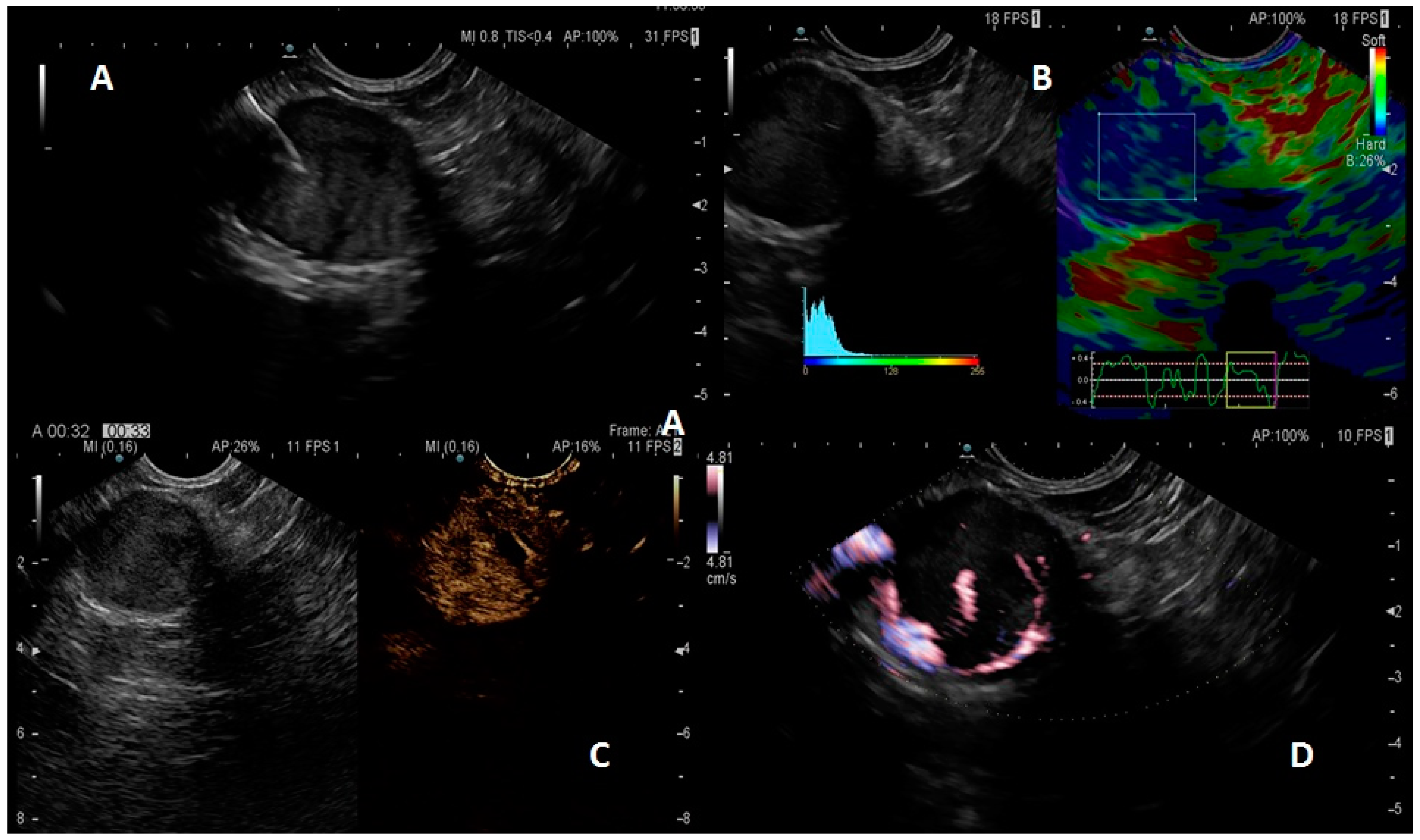 Diagnostics 13 01561 g001