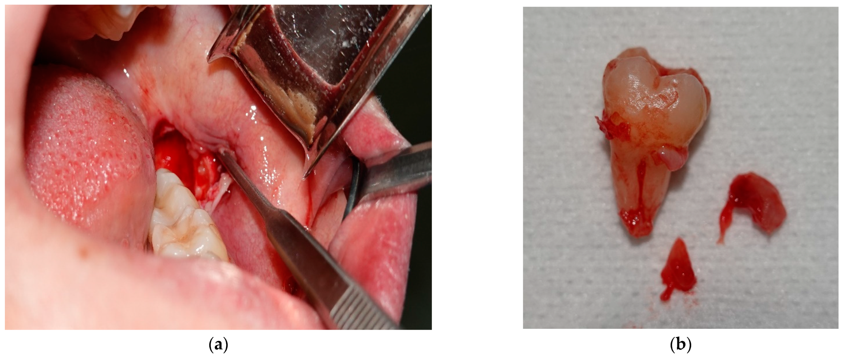 Diagnostics 13 01567 g003