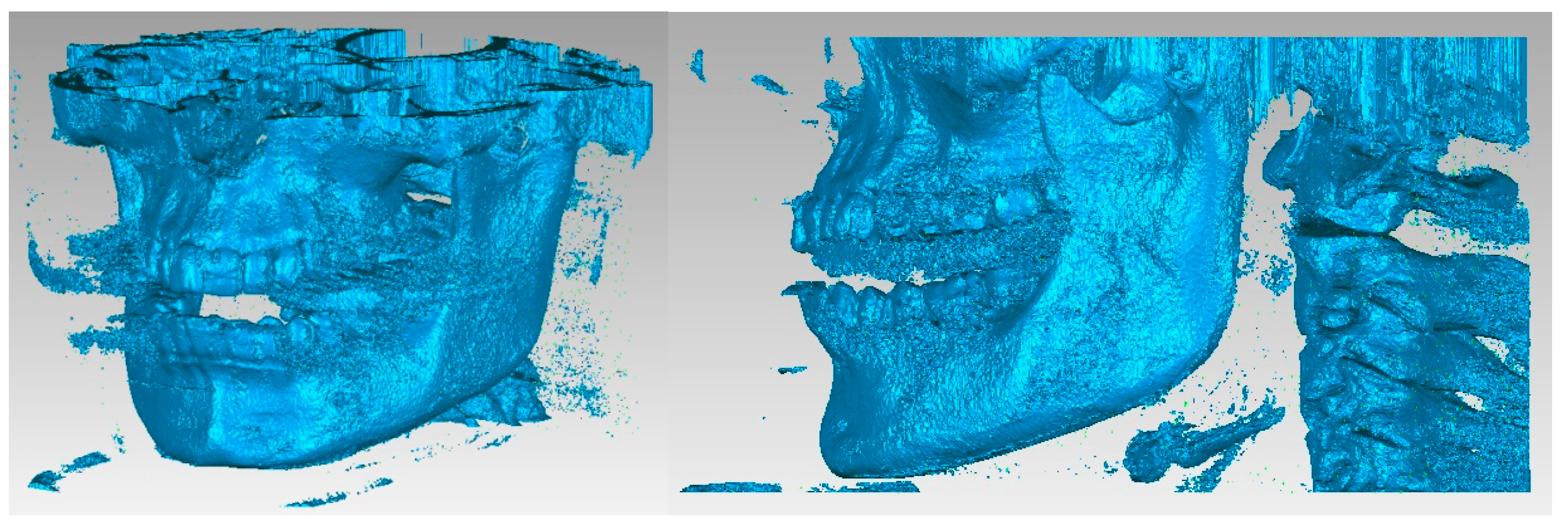 Diagnostics 13 01567 g004