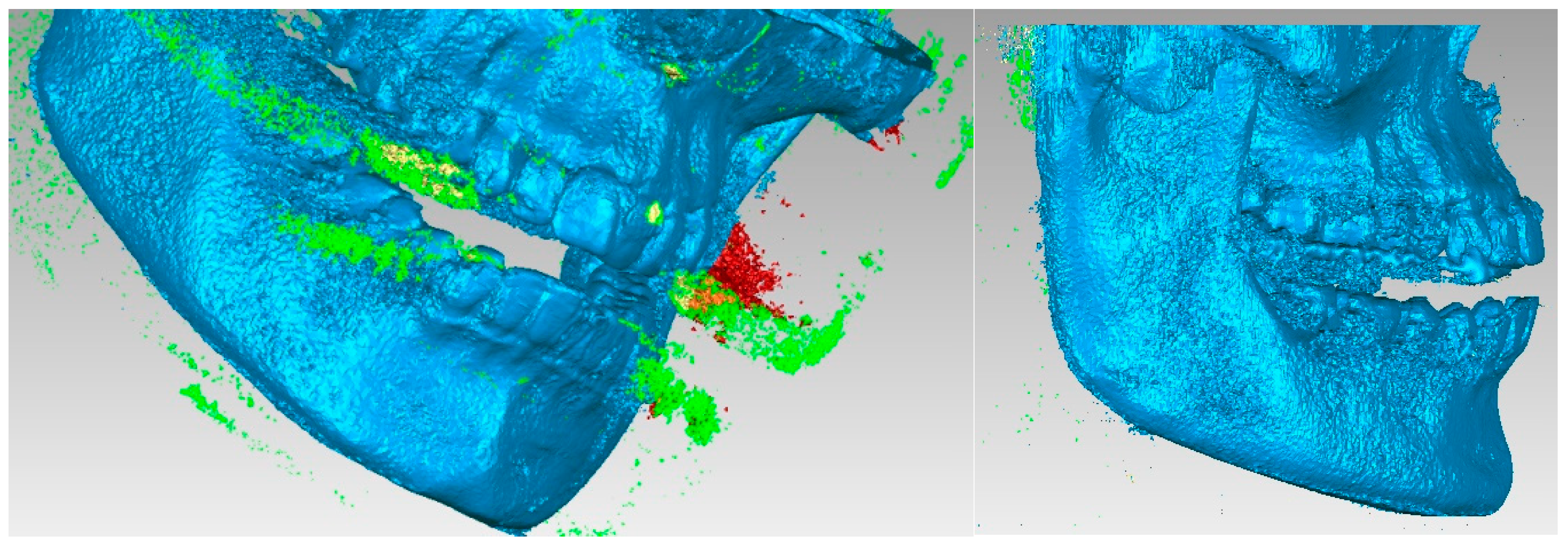 Diagnostics 13 01567 g006