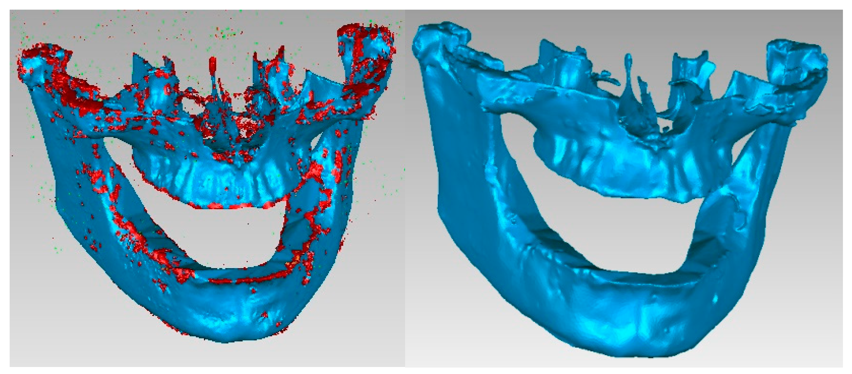 Diagnostics 13 01567 g008