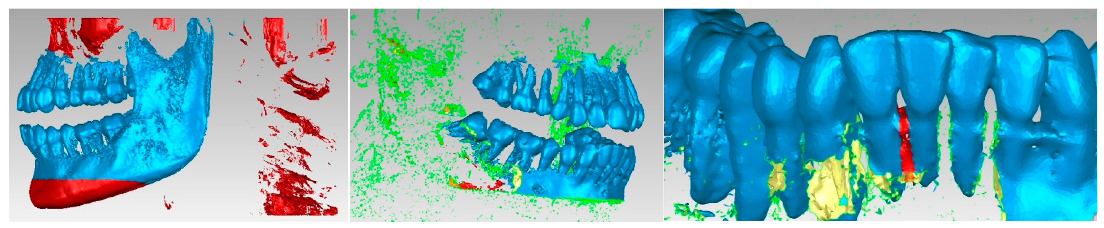 Diagnostics 13 01567 g010
