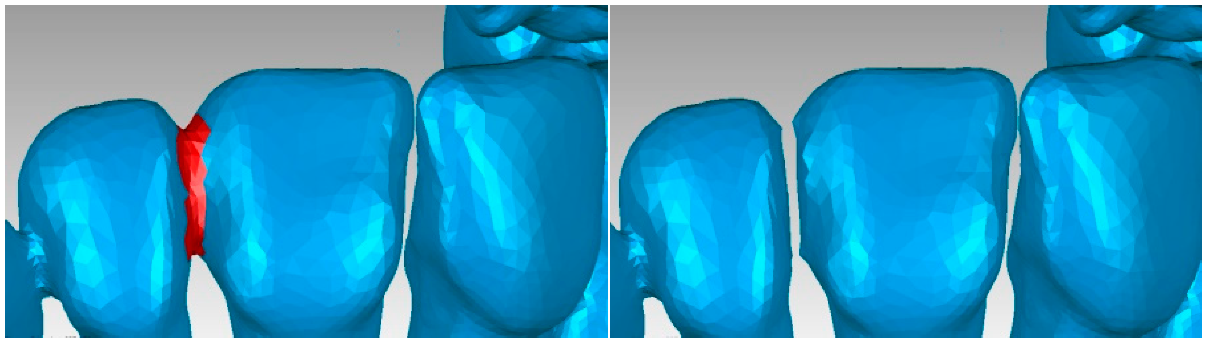 Diagnostics 13 01567 g012