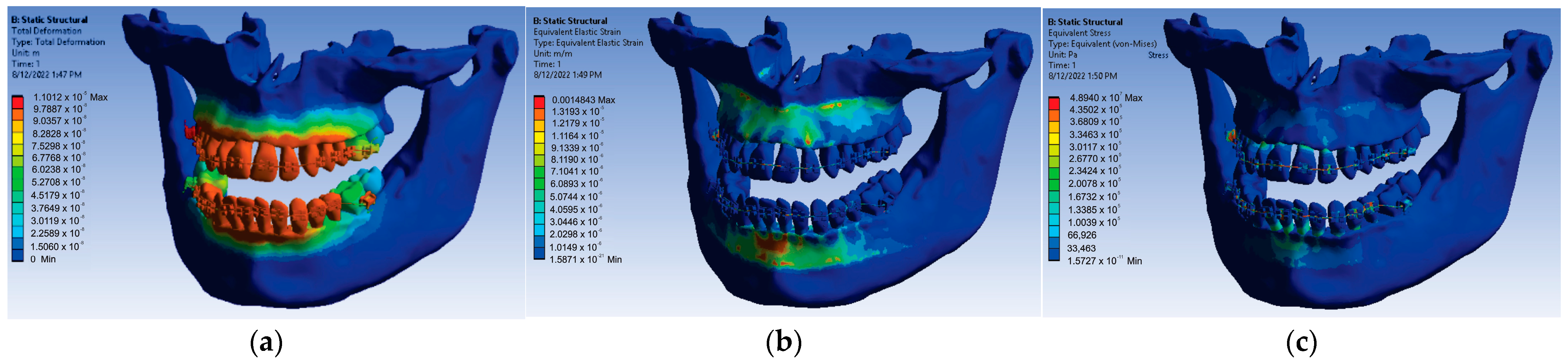 Diagnostics 13 01567 g021