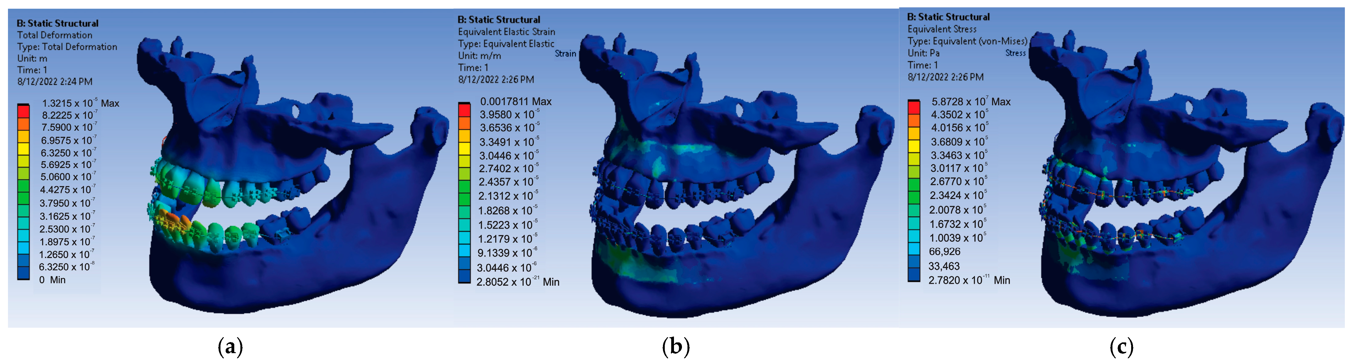 Diagnostics 13 01567 g023