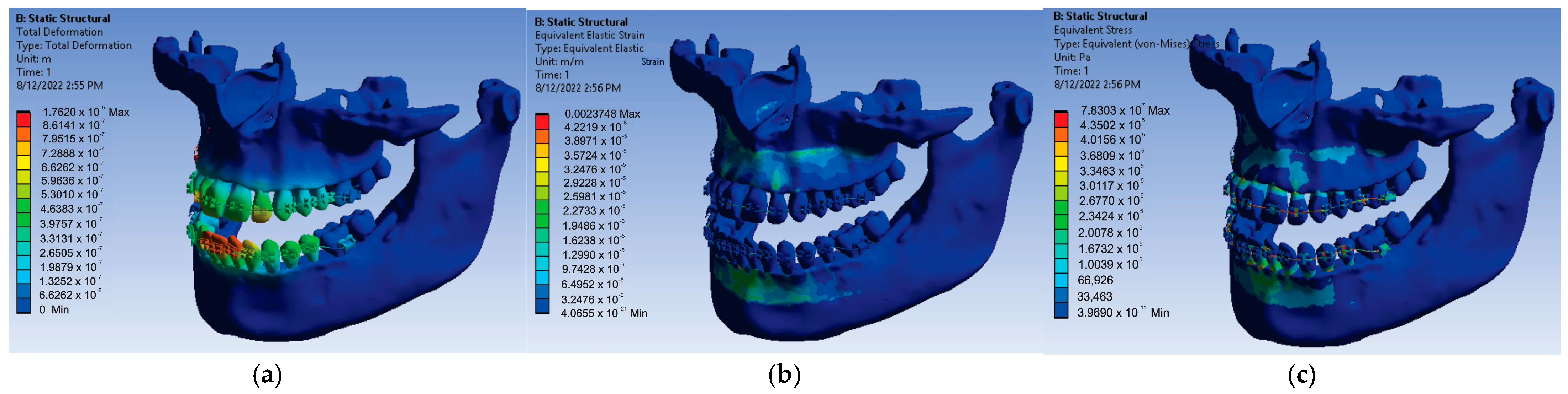 Diagnostics 13 01567 g025