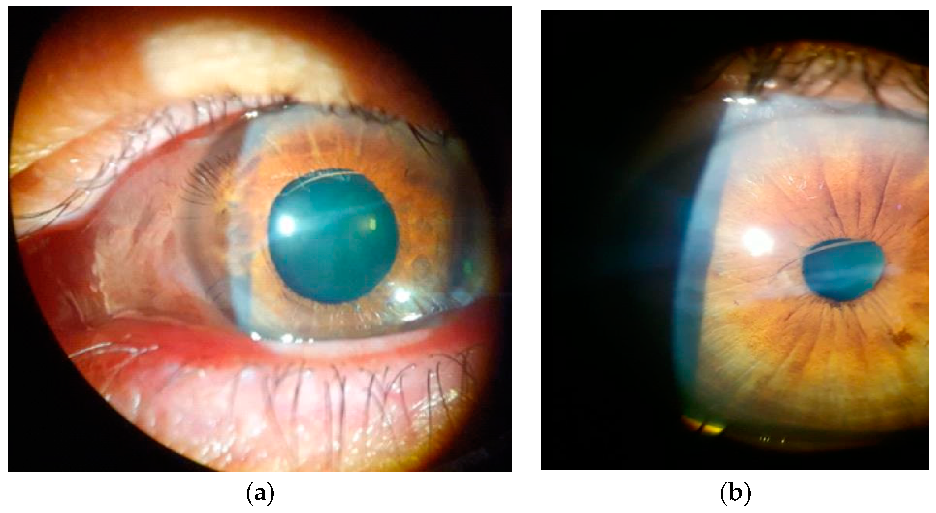 Diagnostics Free FullText PostTraumatic Cilia Remaining Inert in