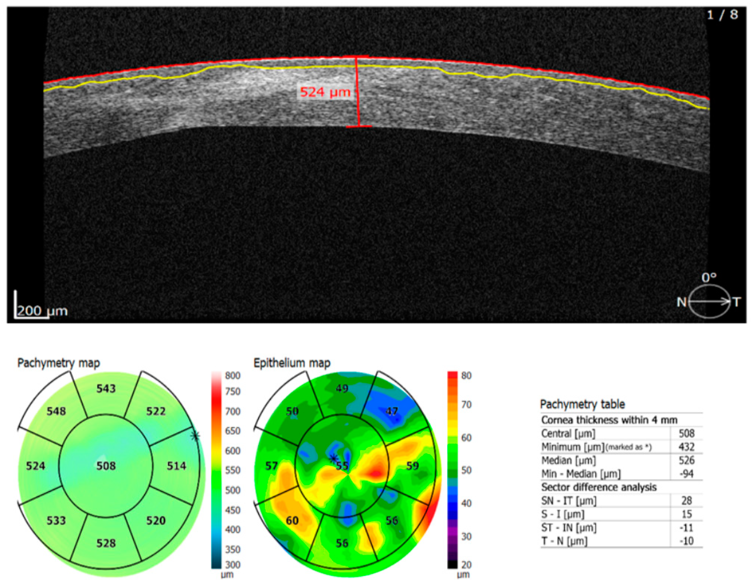 Diagnostics 13 01575 g002