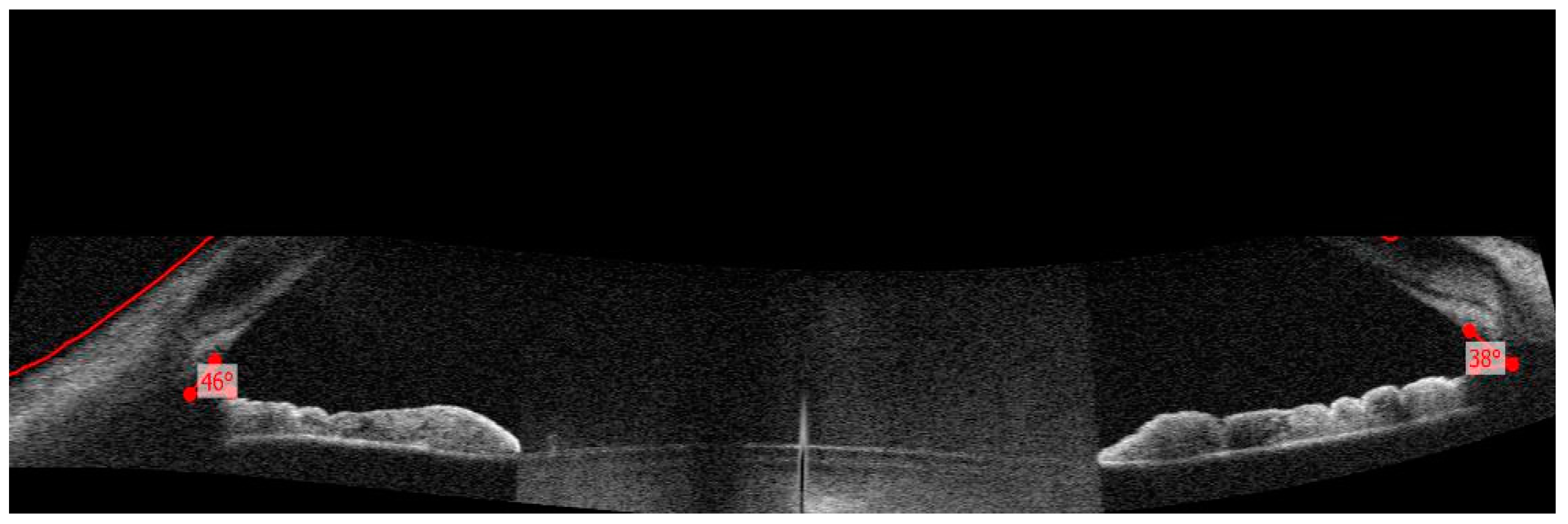 Diagnostics 13 01575 g003