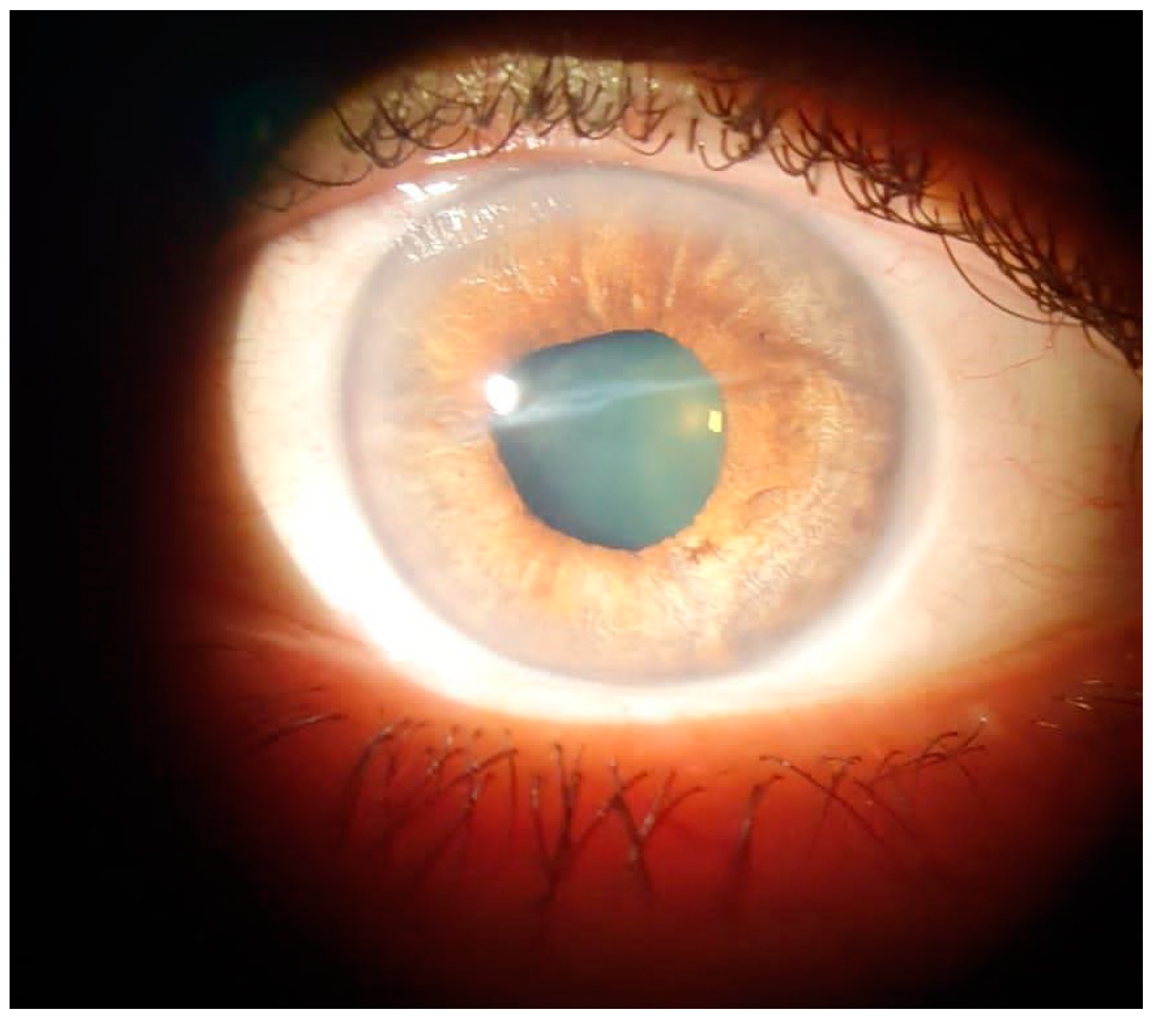 Diagnostics 13 01575 g004