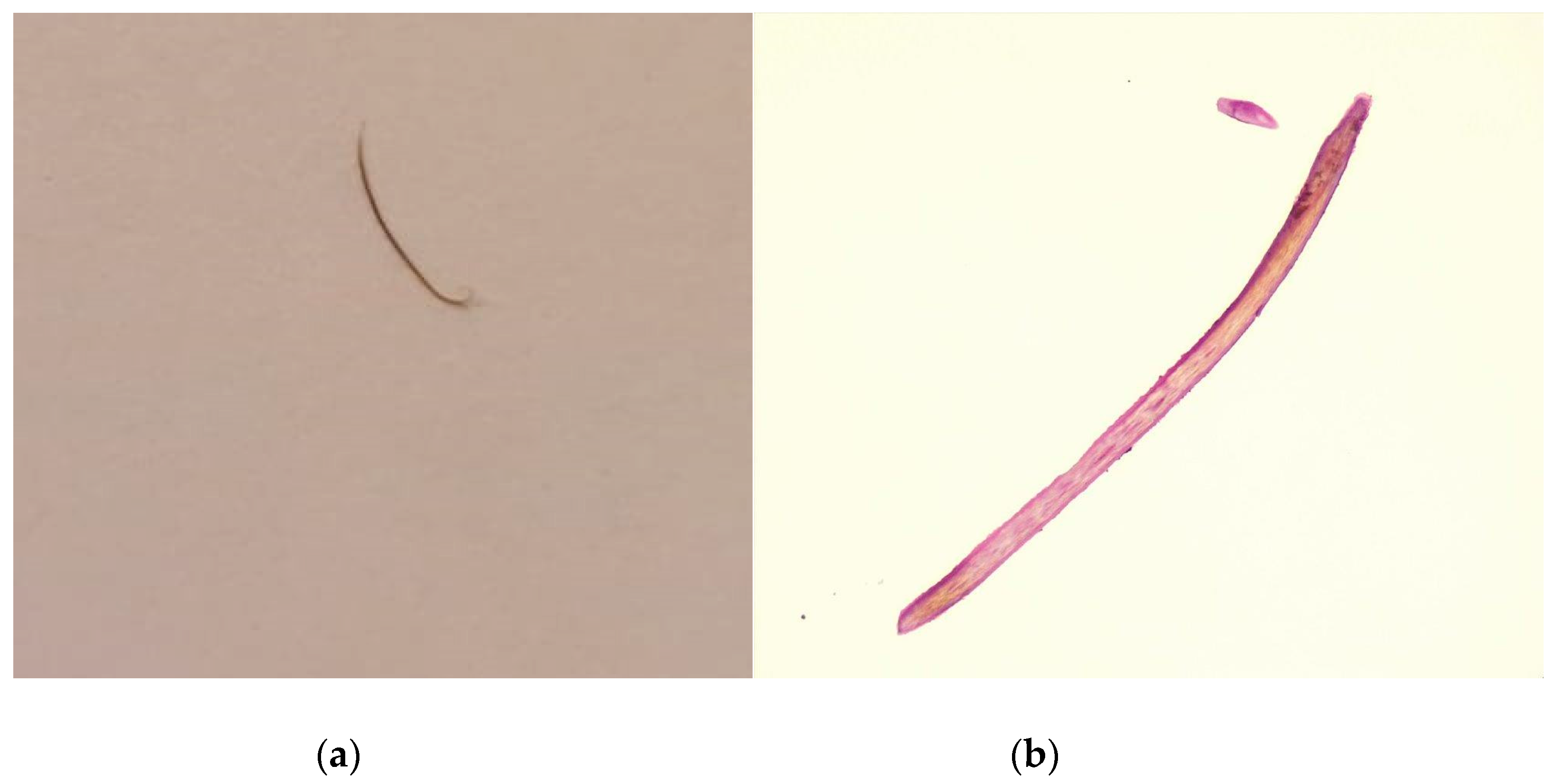 Diagnostics 13 01575 g005