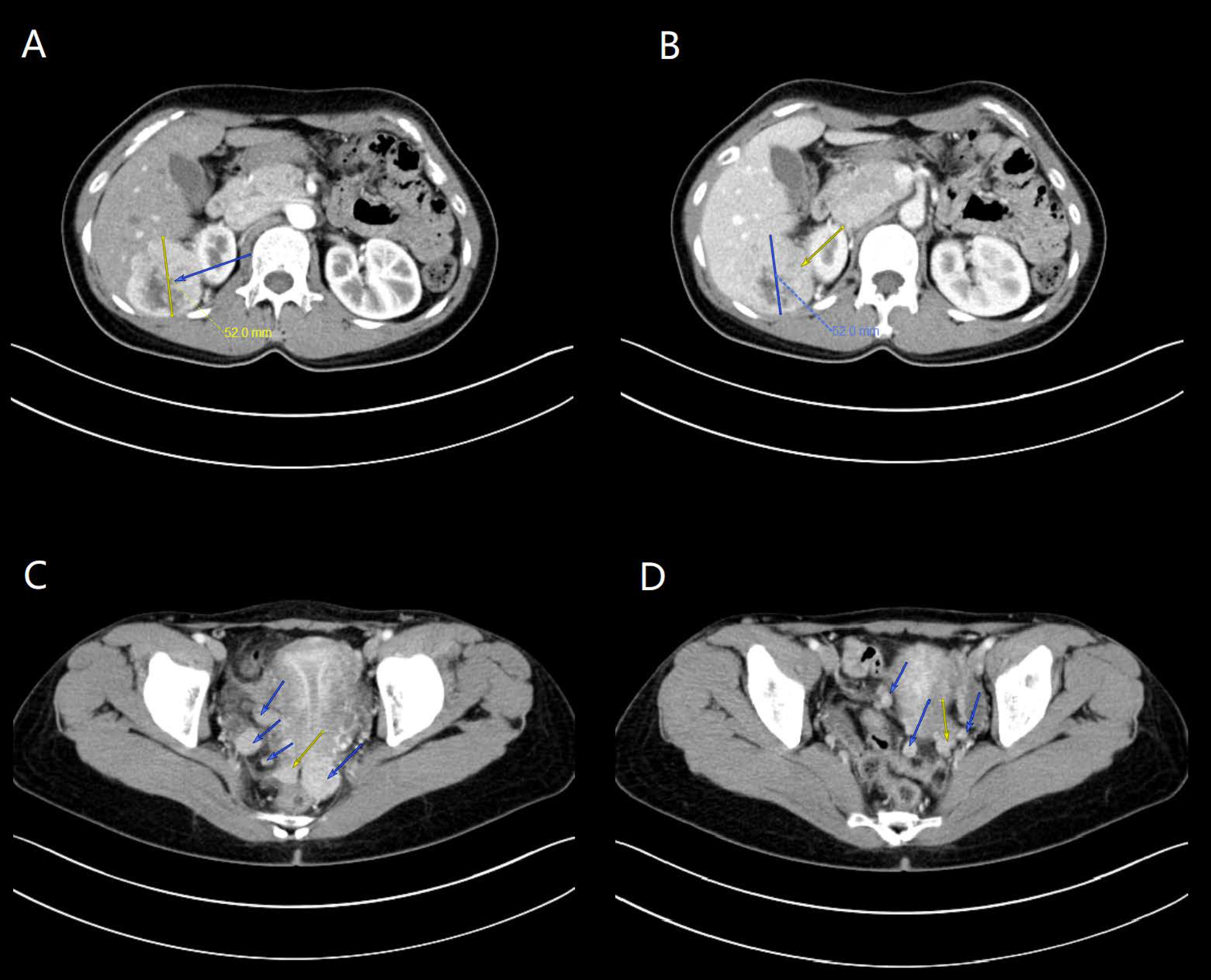 Diagnostics 13 01581 g002 Diagnostics 13 01581 g002