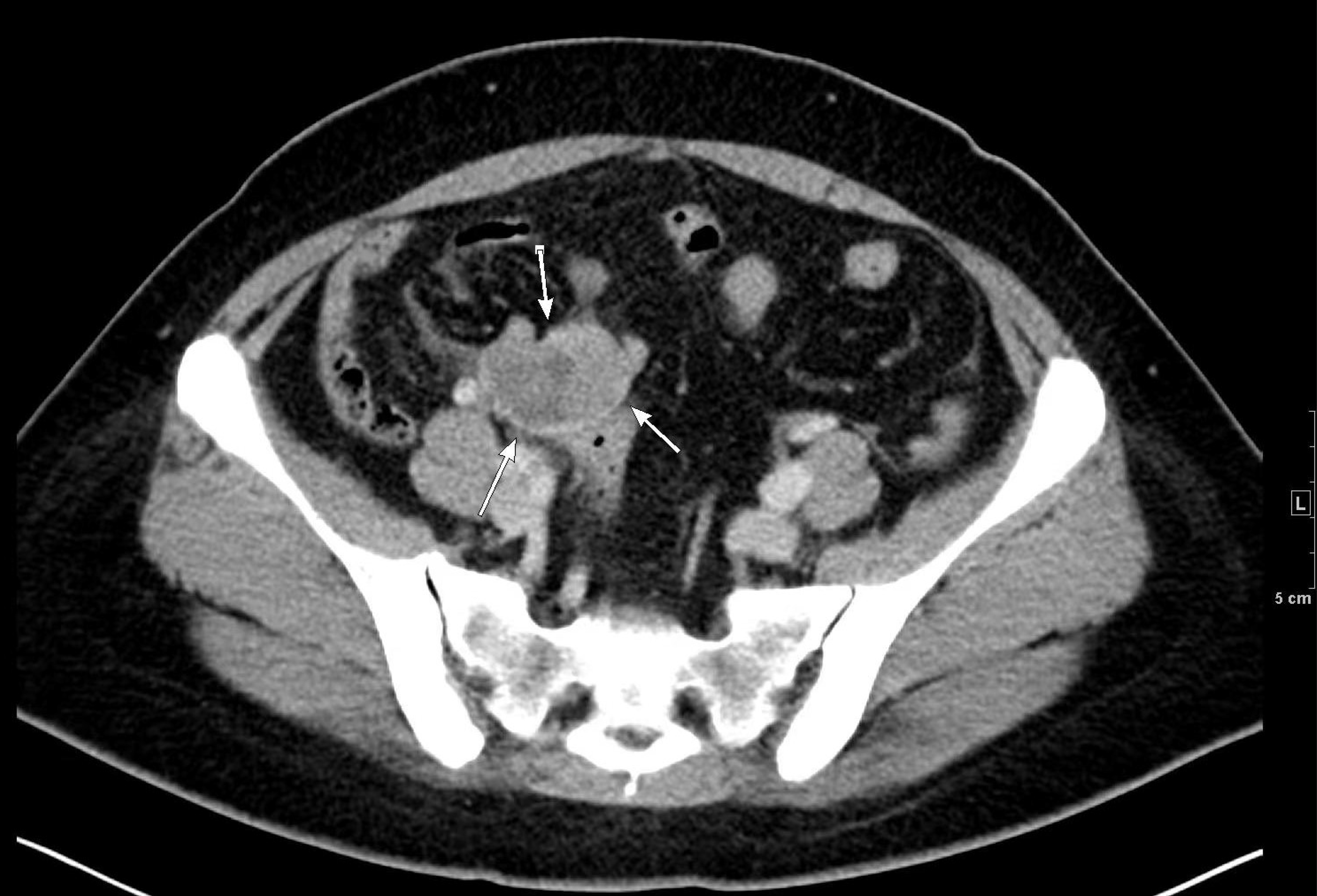 Diagnostics 13 01581 g005 Diagnostics 13 01581 g005