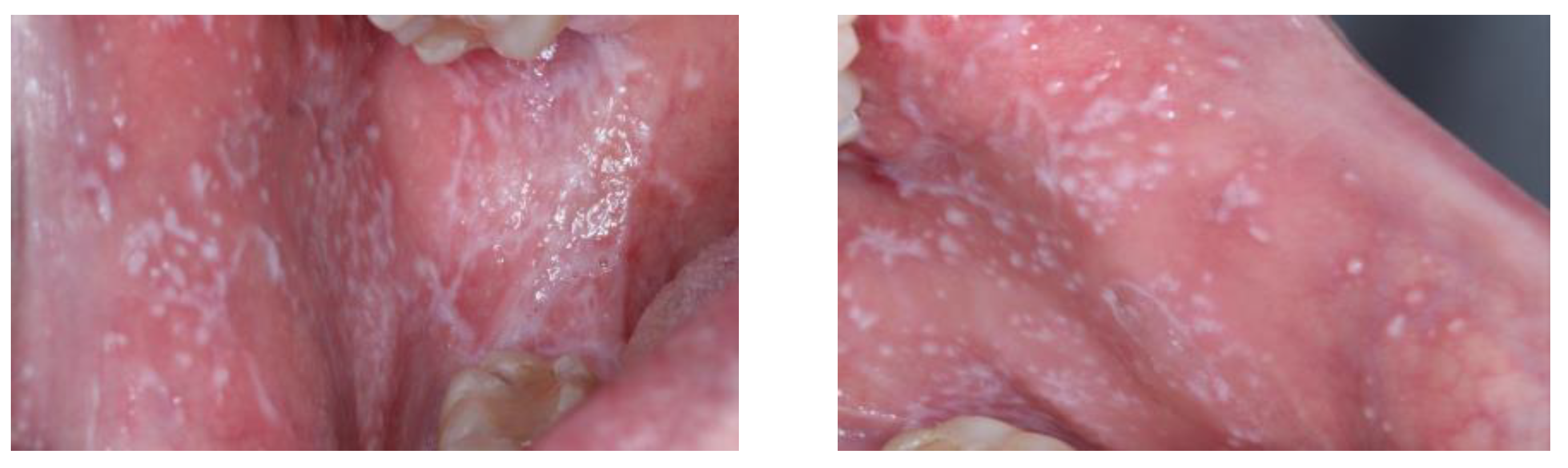 Diagnostics 13 01586 g001