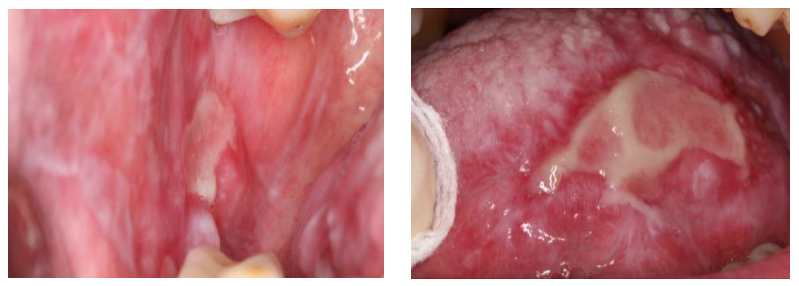 Diagnostics 13 01586 g002