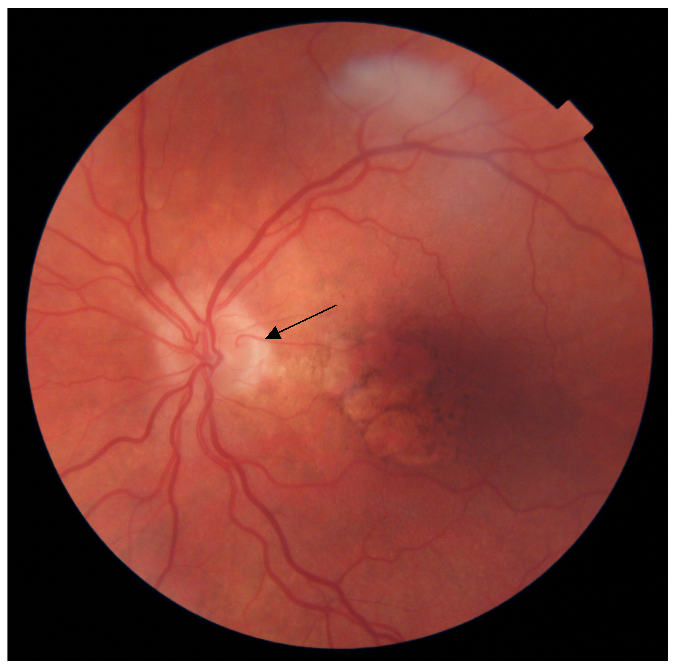 Diagnostics 13 01593 g001 Diagnostics 13 01593 g001