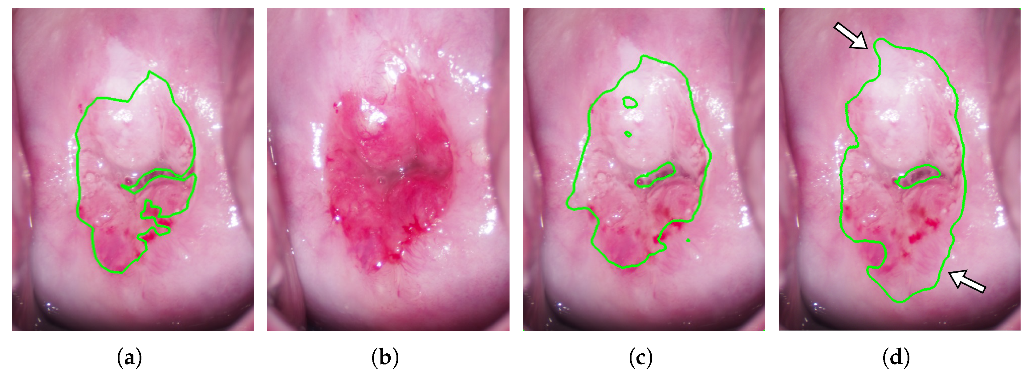 Diagnostics 13 01596 g005