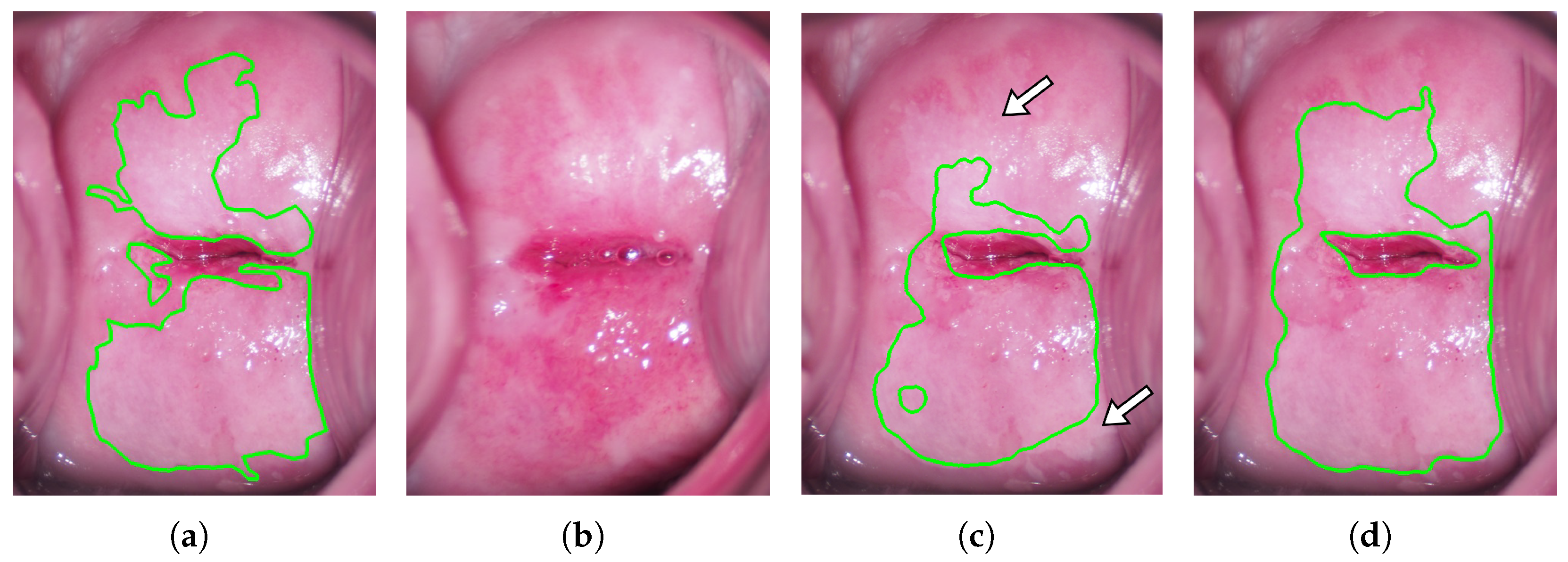 Diagnostics 13 01596 g006