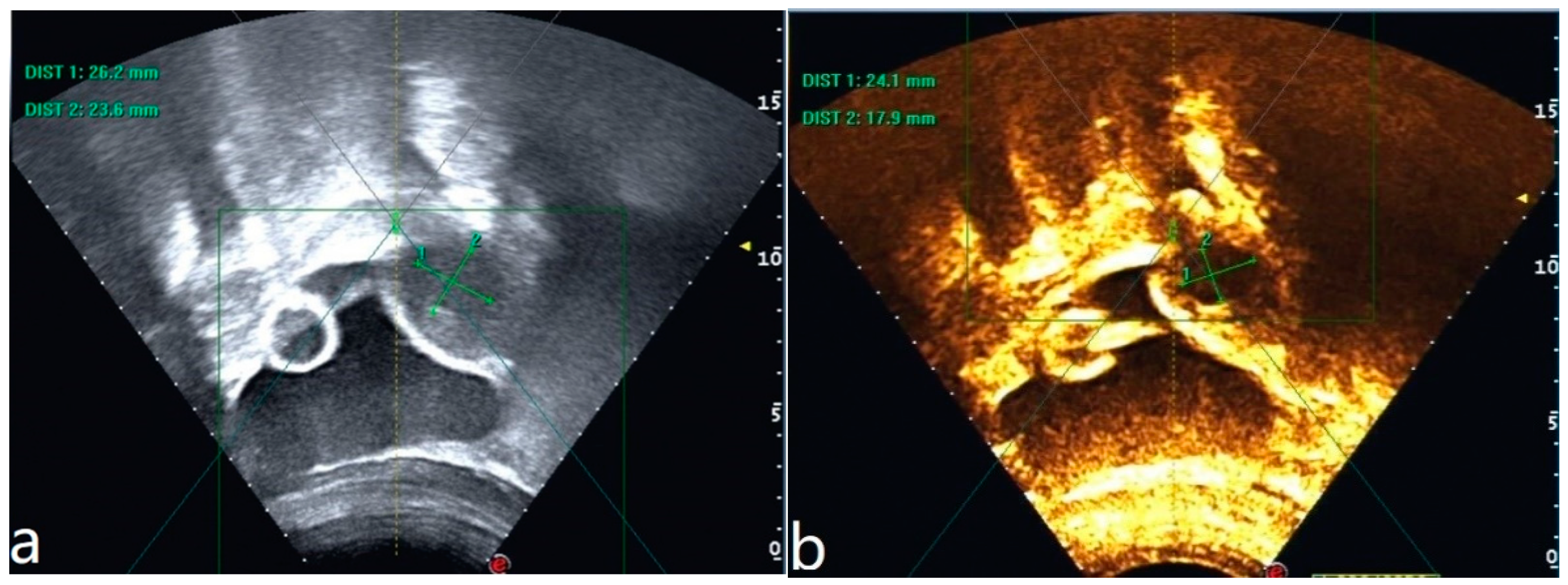 Diagnostics 13 01608 g002 Diagnostics 13 01608 g002