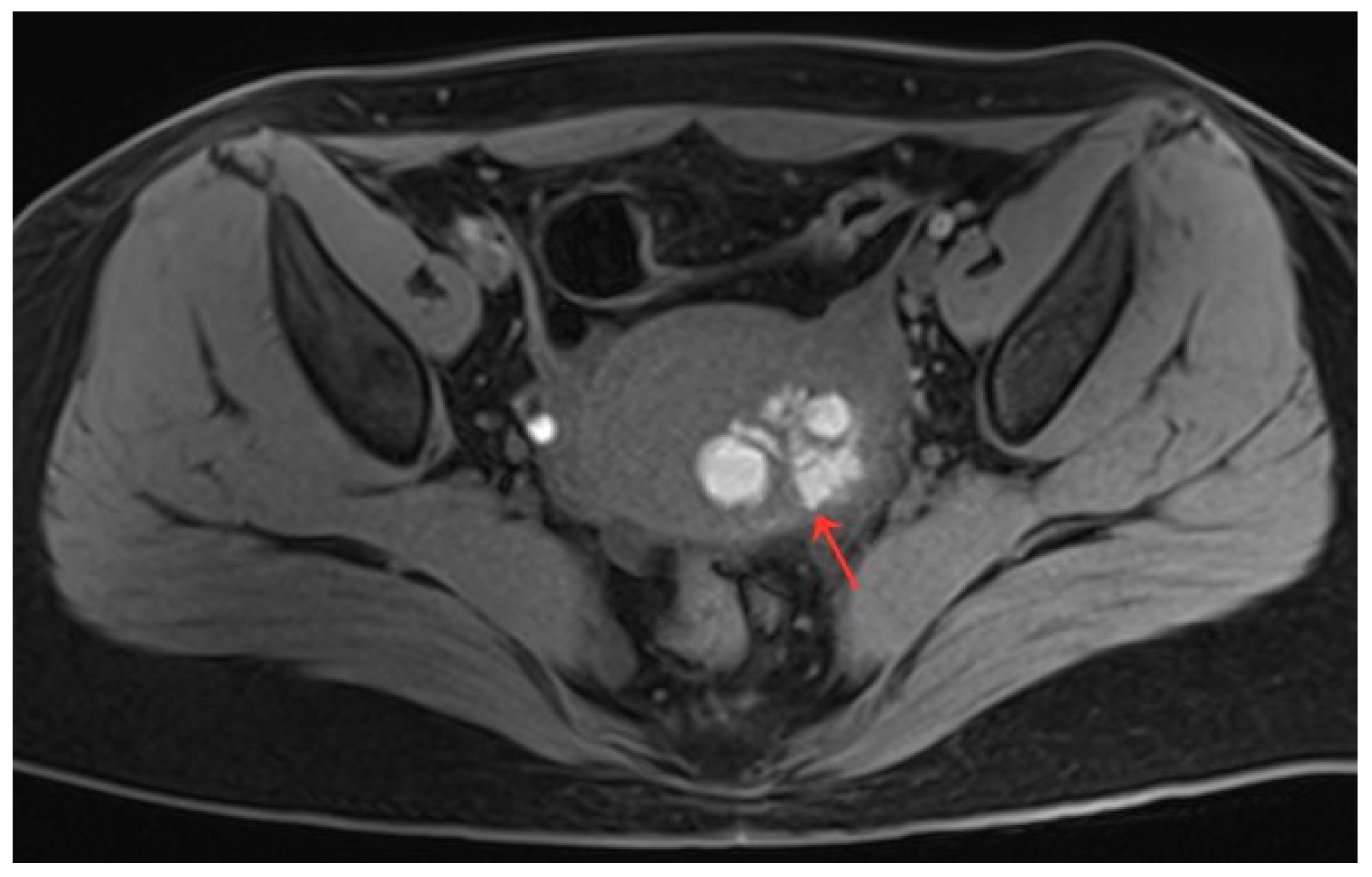 Diagnostics 13 01608 g005 Diagnostics 13 01608 g005