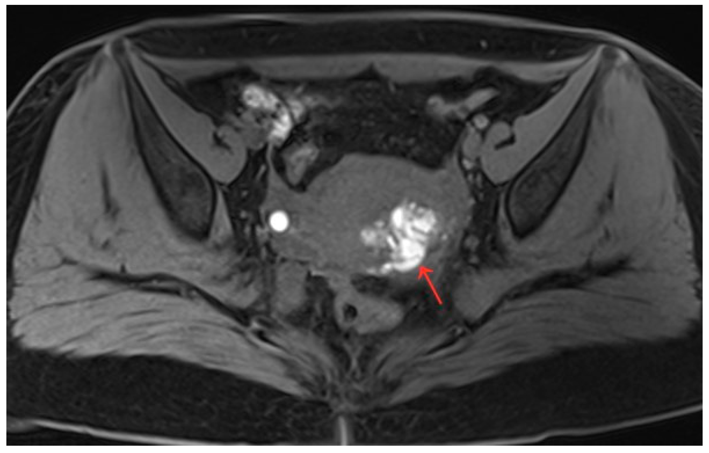 Diagnostics 13 01608 g006 Diagnostics 13 01608 g006