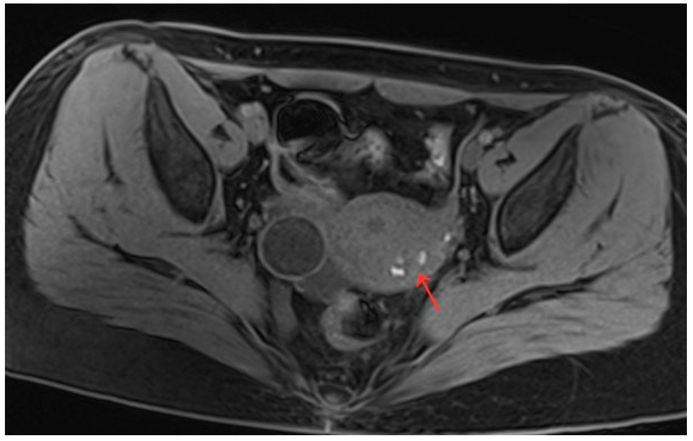 Diagnostics 13 01608 g007 Diagnostics 13 01608 g007