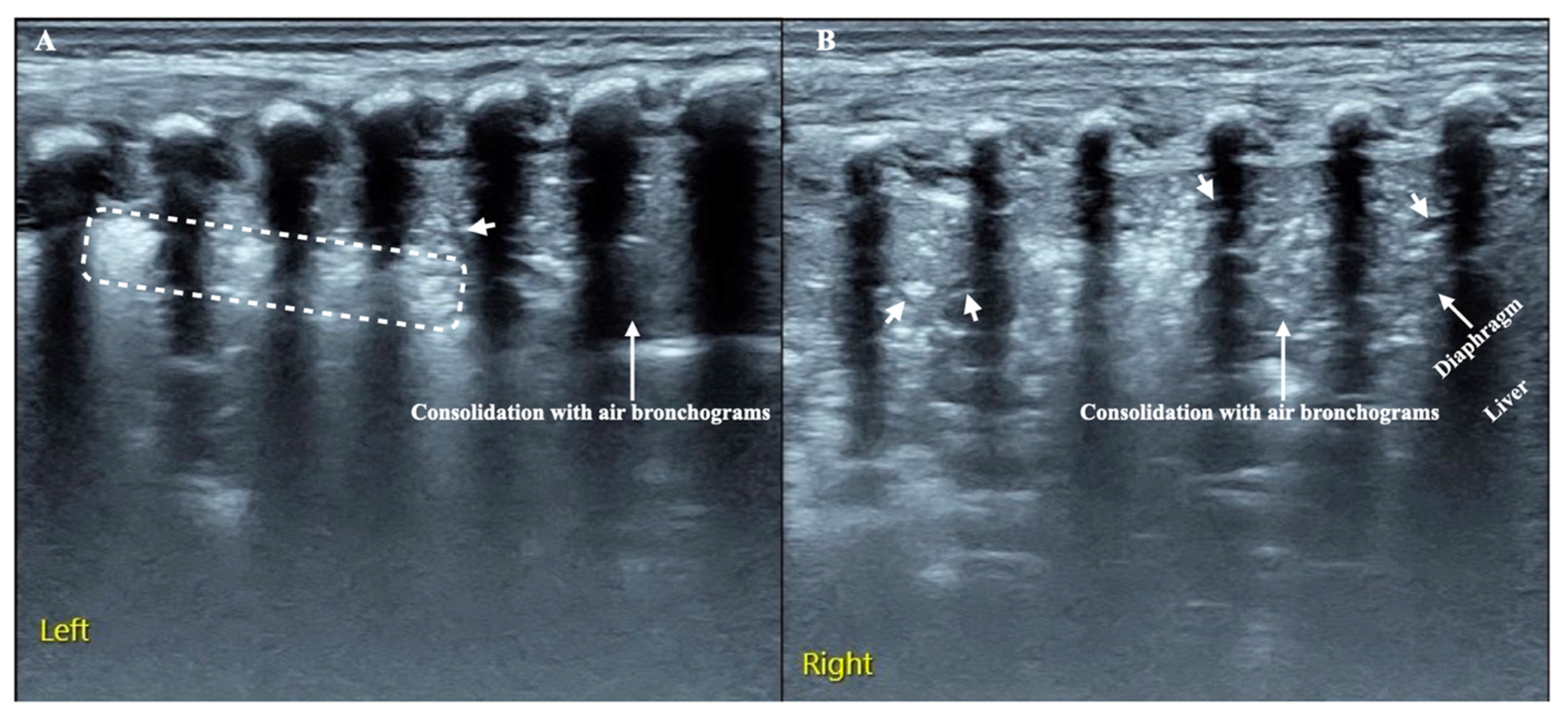 Diagnostics 13 01612 g005