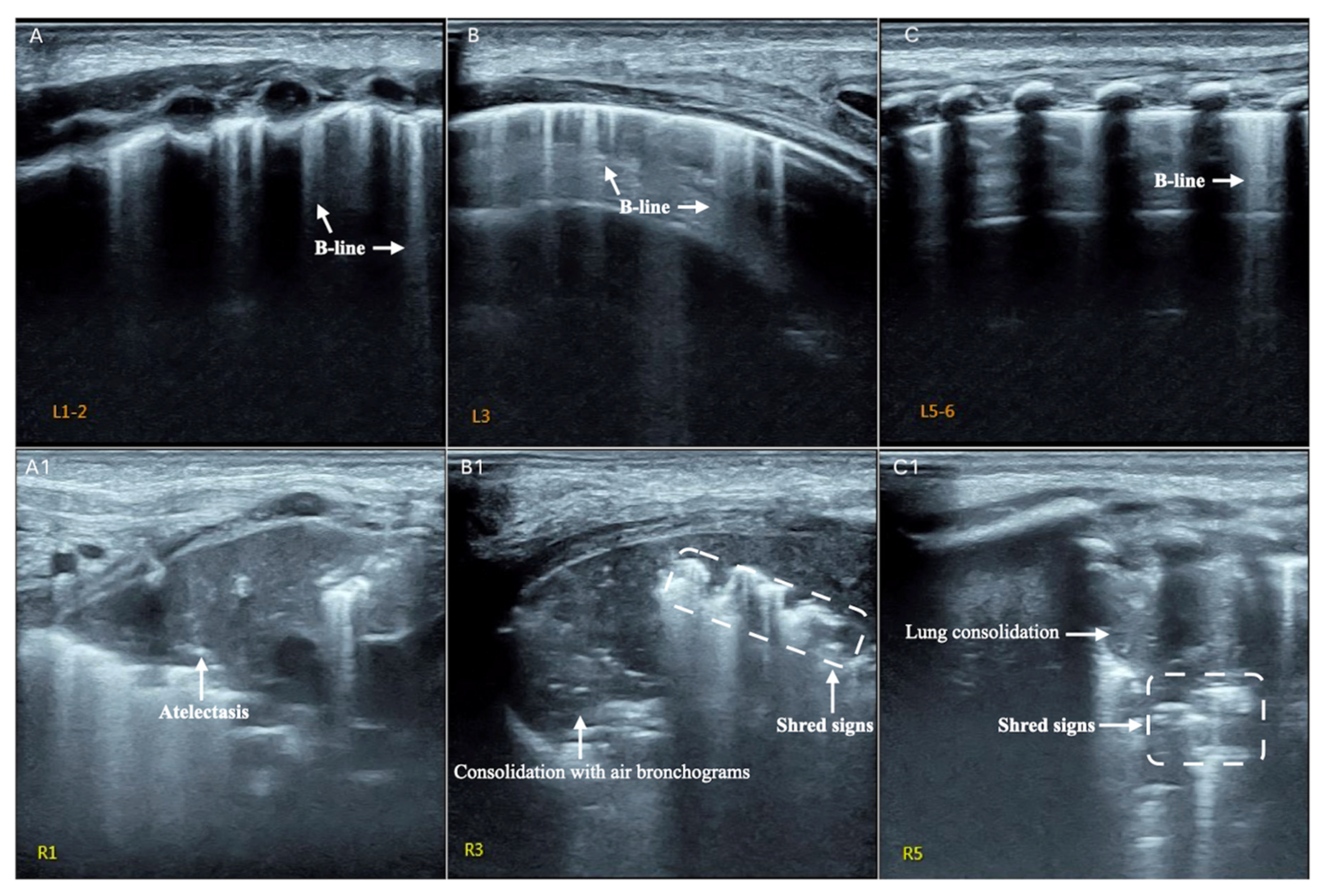 Diagnostics 13 01612 g006