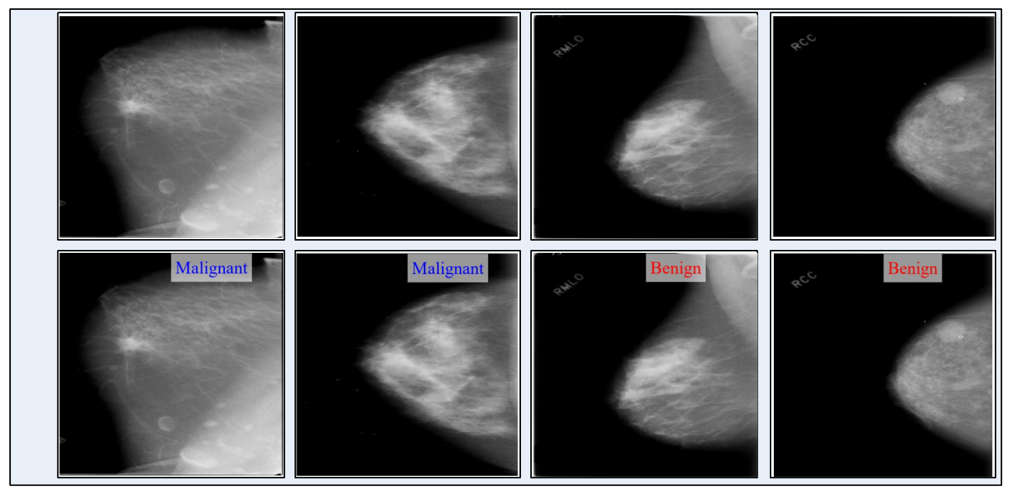 Diagnostics 13 01618 g019 Diagnostics 13 01618 g019