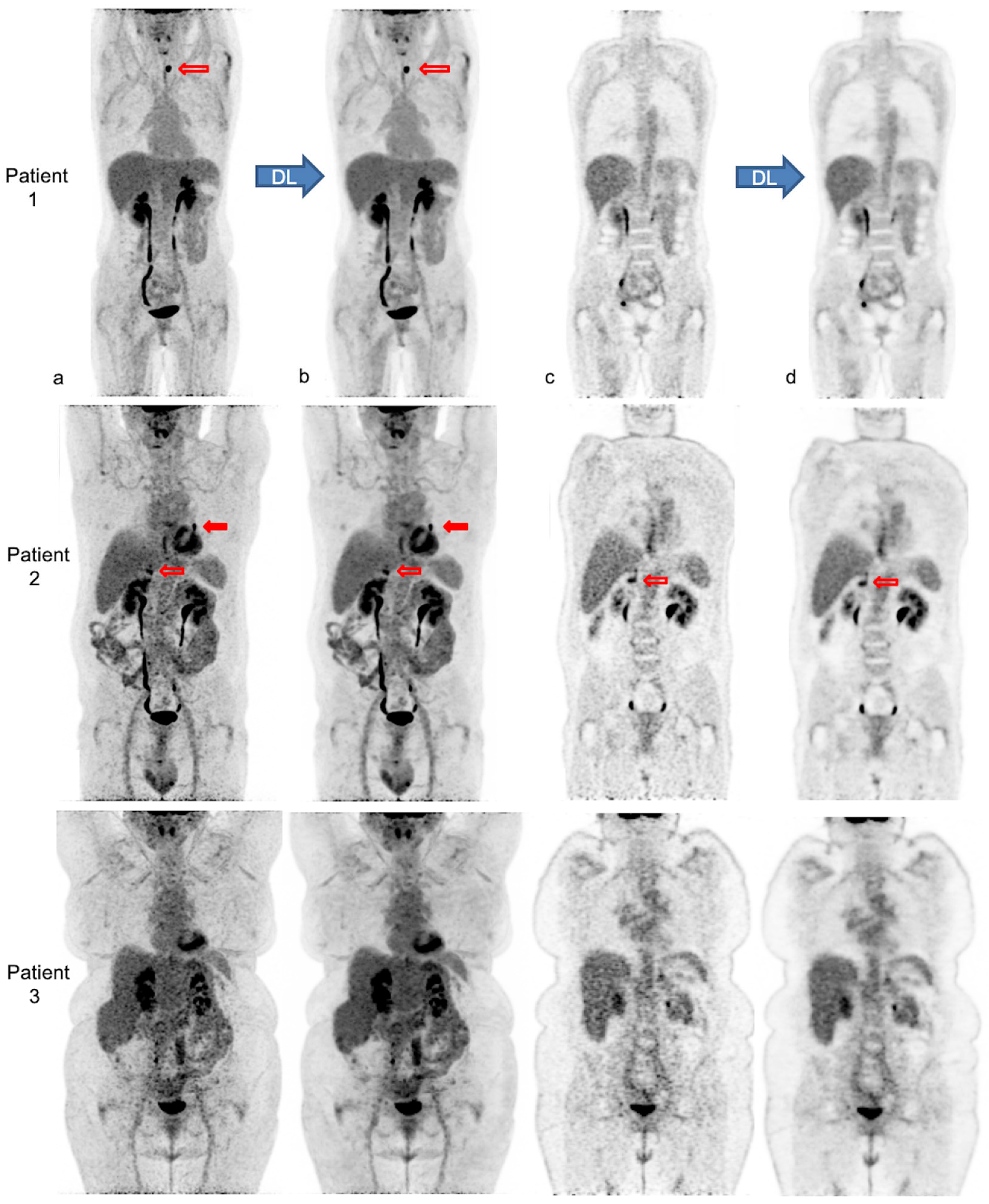 Diagnostics 13 01626 g004