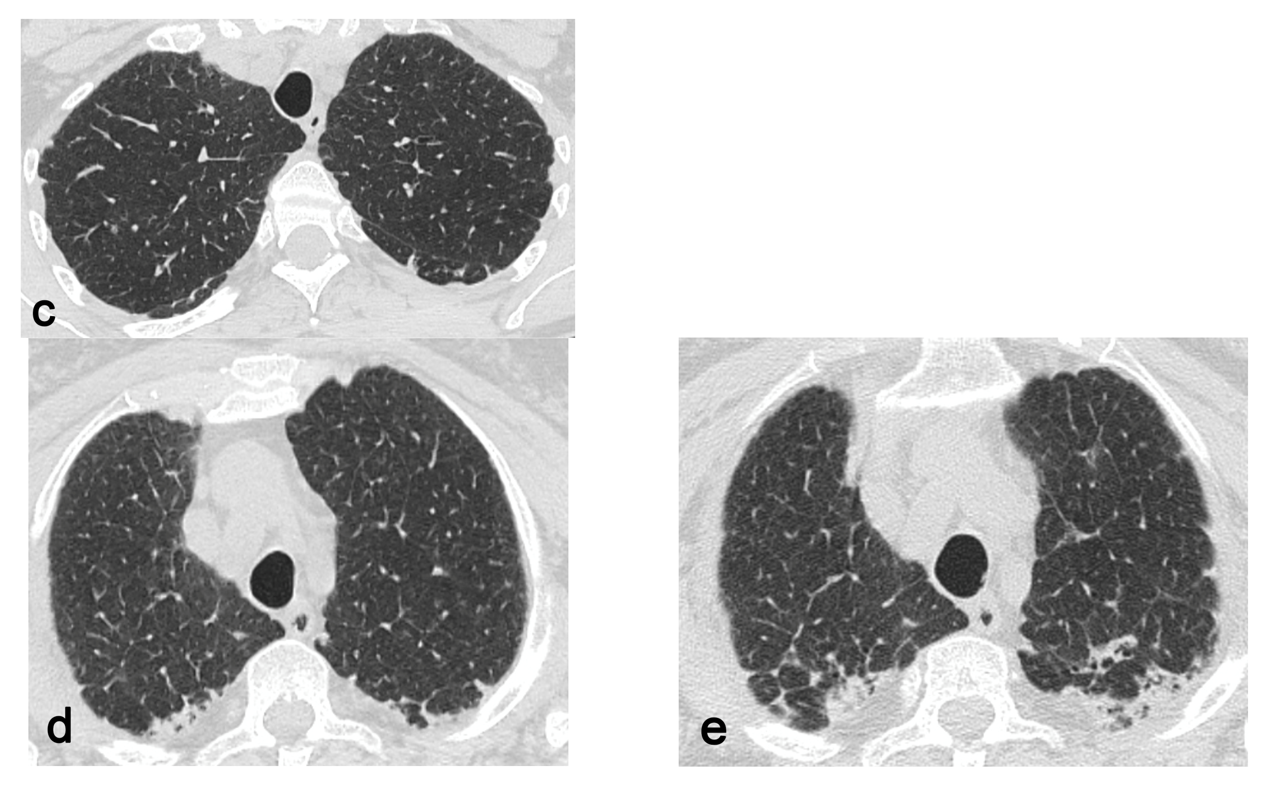Diagnostics 13 01627 g002b