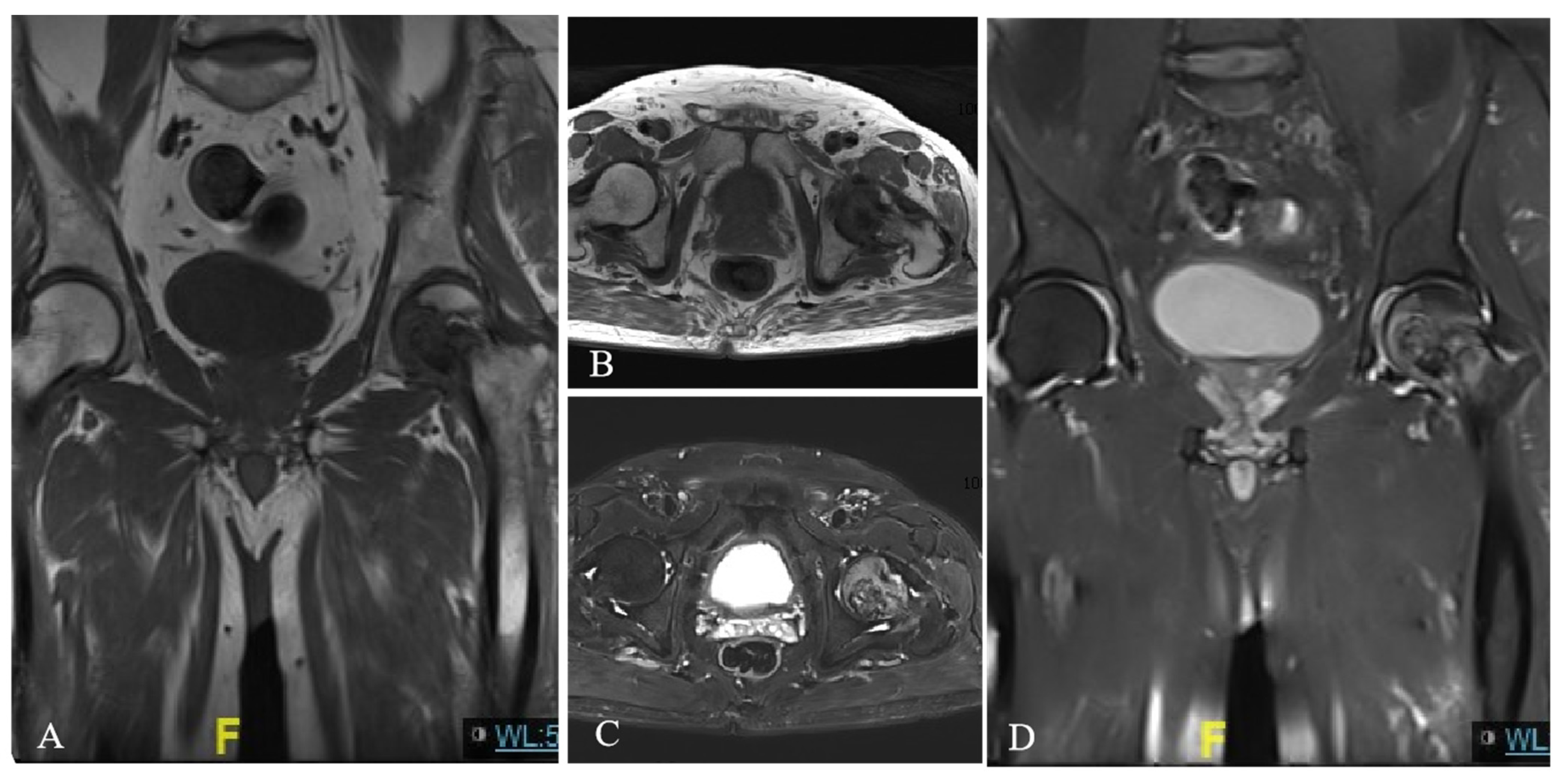 Diagnostics 13 01632 g002 Diagnostics 13 01632 g002