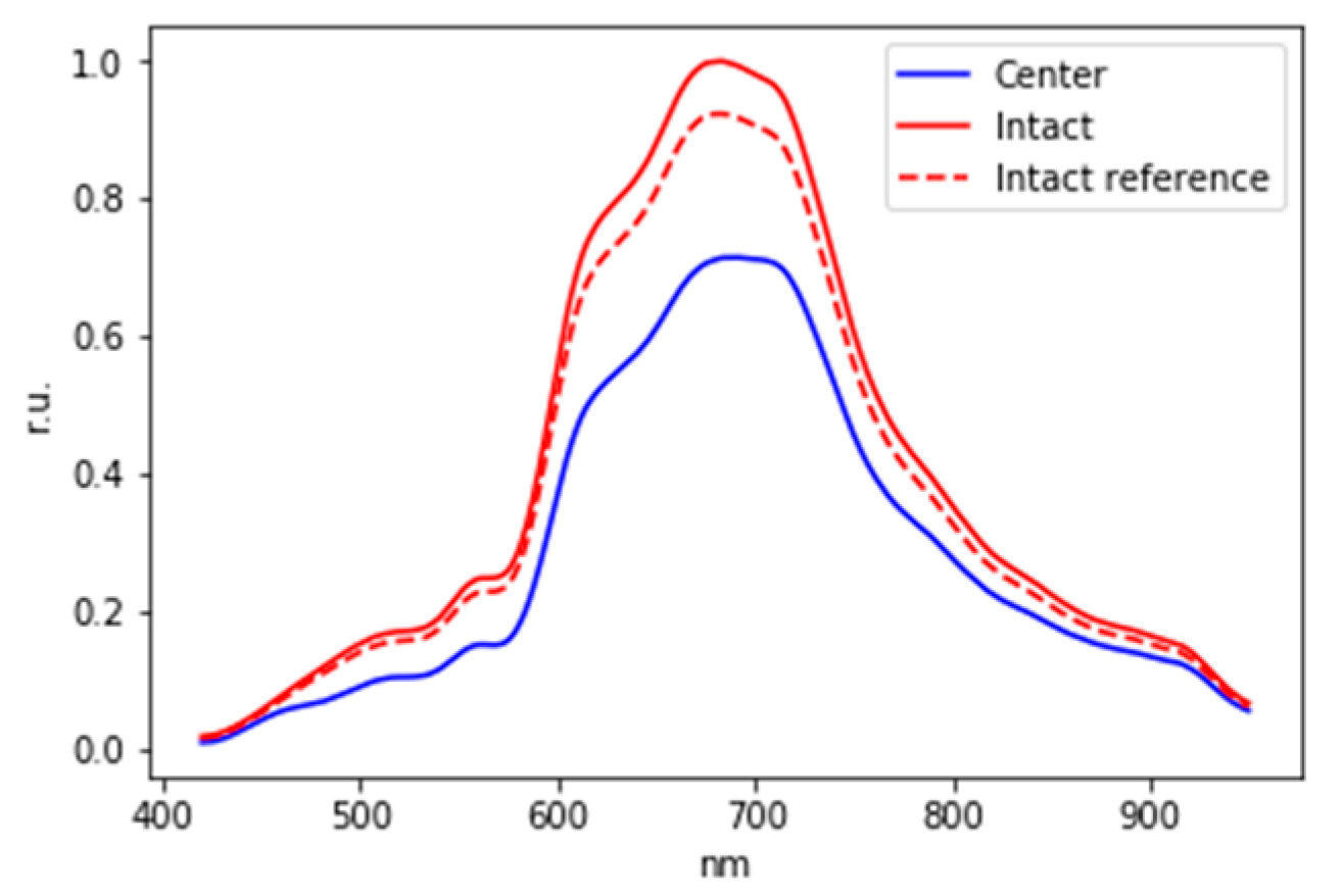 Diagnostics 13 01633 g008