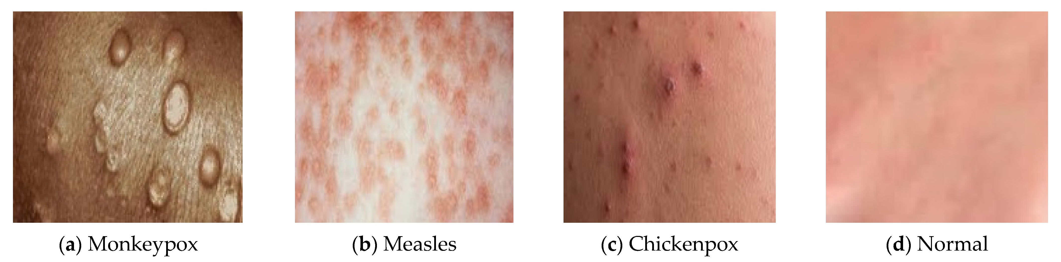 Diagnostics 13 01639 g001