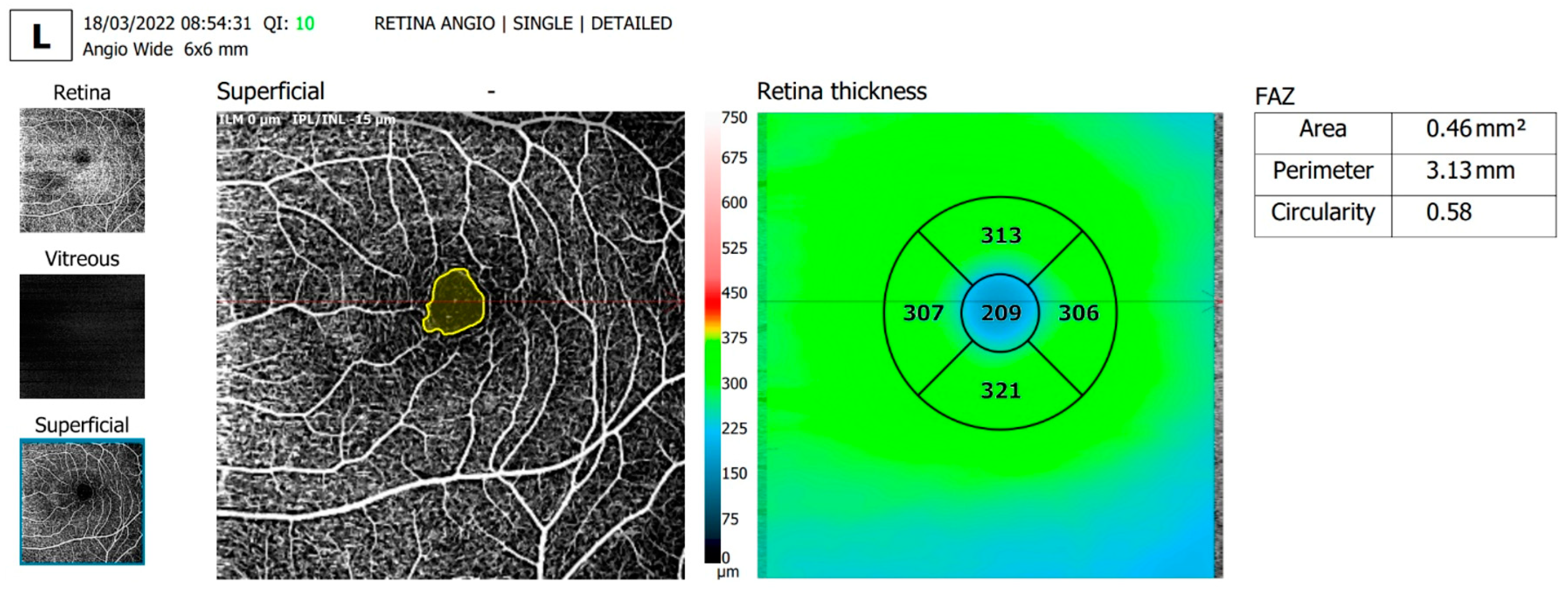 Diagnostics 13 01648 g002 Diagnostics 13 01648 g002