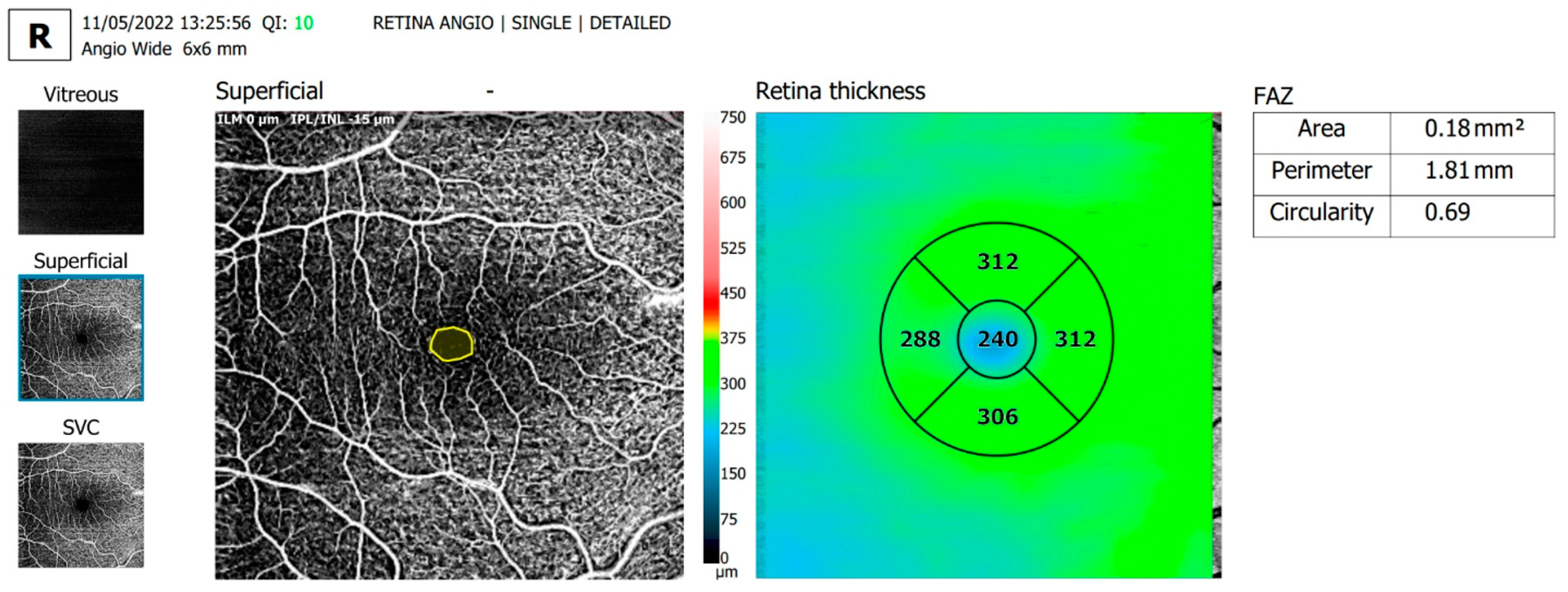 Diagnostics 13 01648 g003 Diagnostics 13 01648 g003