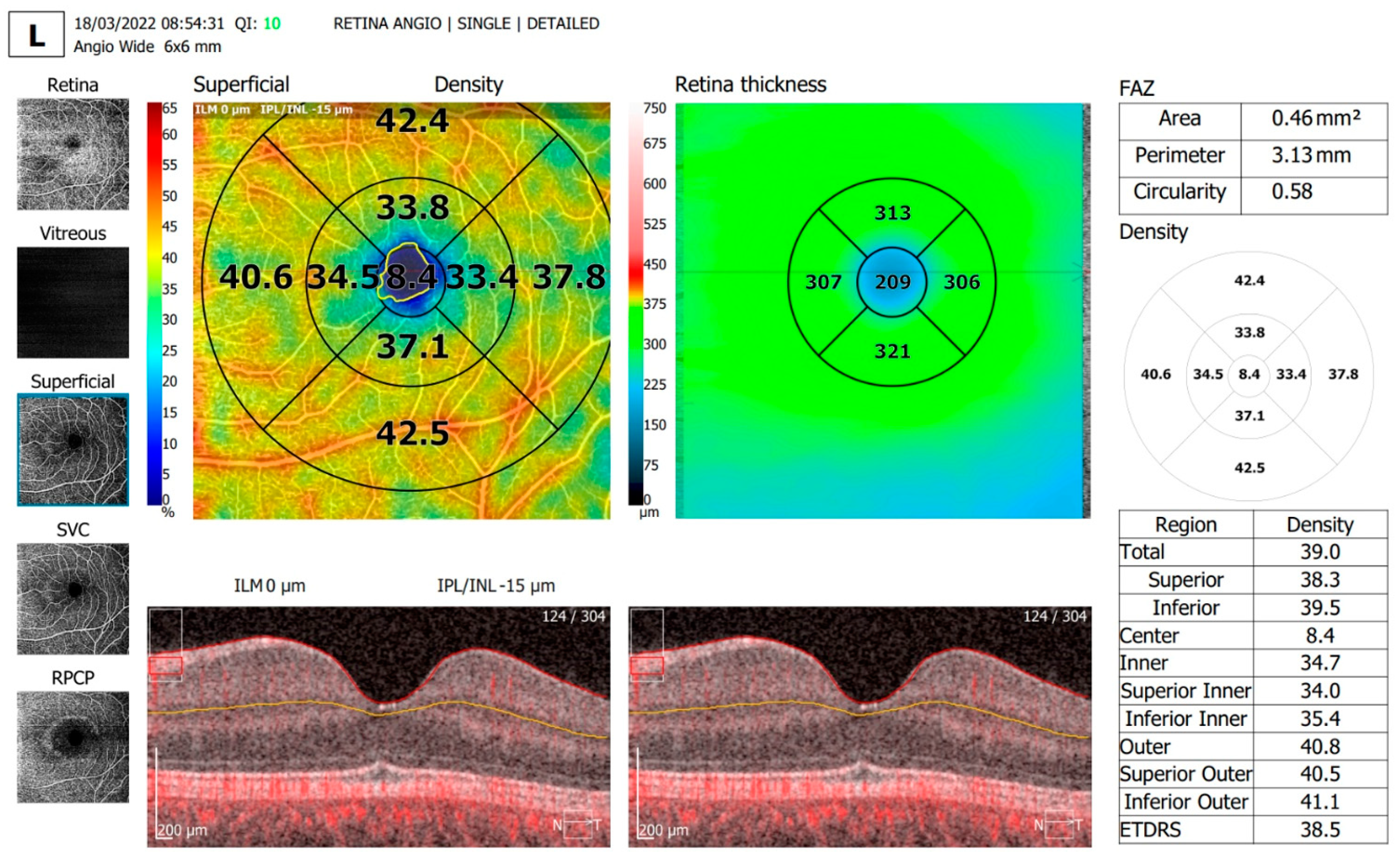 Diagnostics 13 01648 g004 Diagnostics 13 01648 g004