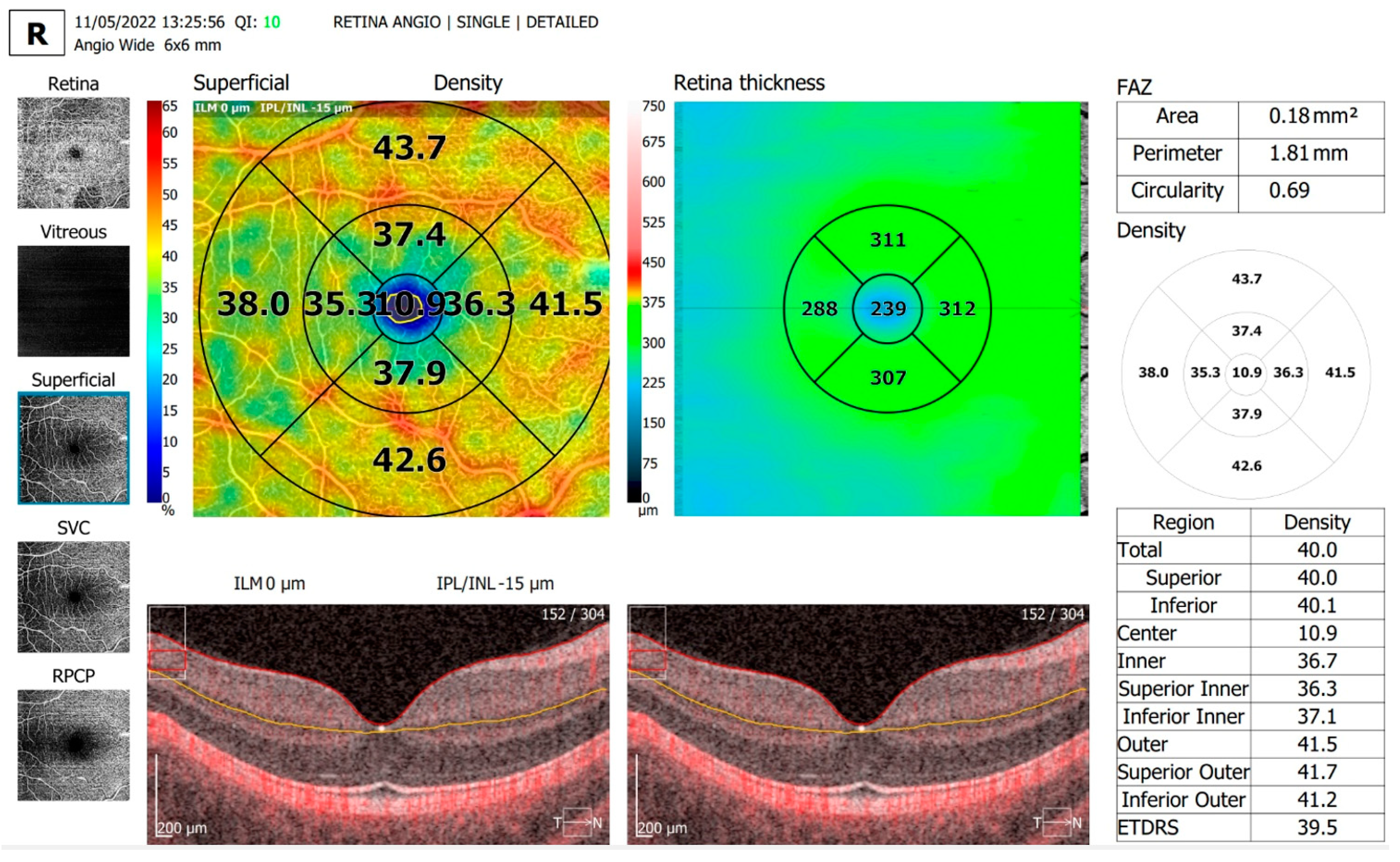 Diagnostics 13 01648 g005 Diagnostics 13 01648 g005