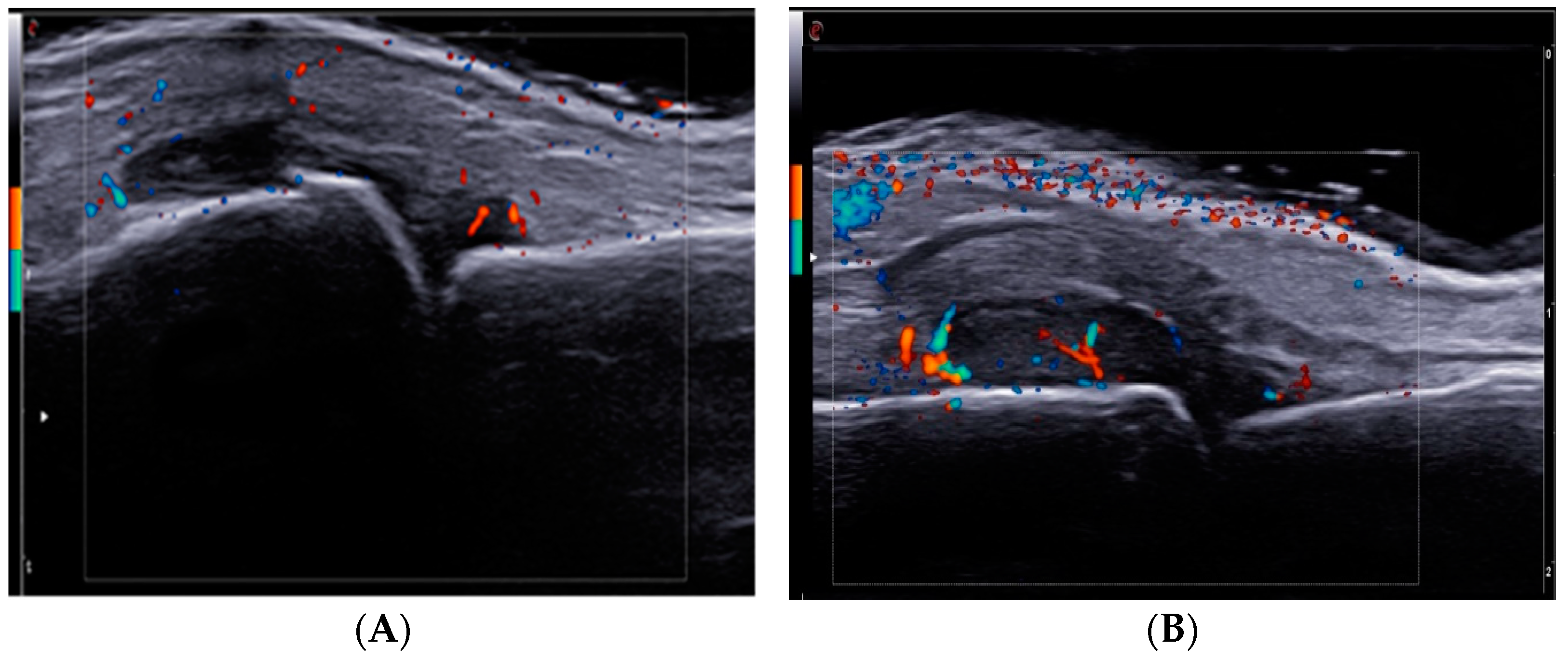 Diagnostics 13 01653 g002 Diagnostics 13 01653 g002